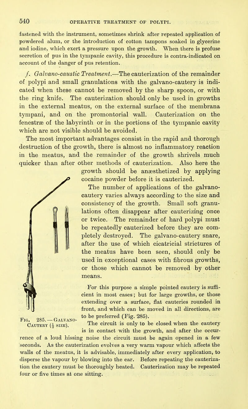 fastened with the instrument, sometimes shrink after repeated appUcation of powdered alum, or the introduction of cotton tampons soaked in glycerine and iodine, which exert a pressure upon the growth. When there is profuse secretion of pus in the tympanic cavity, this procedure is contra-indicated on account of the danger of pus retention. /. Galvano-caustic Treatment.—The cauterization of the remainder of polypi and small granulations with the galvano-cautery is indi- cated when these cannot be removed by the sharp spoon, or with the ring knife. The cauterization should only be used in growths in the external meatus, on the external surface of the membrana tympani, and on the promontorial wall. Cauterization on the fenestras of the labyrinth or in the portions of the tympanic cavity which are not visible should be avoided. The most important advantages consist in the rapid and thorough destruction of the growth, there is almost no inflammatory reaction in the meatus, and the remainder of the growth shrivels much quicker than after other methods of cauterization. Also here the growth should be anaesthetized by applying cocaine powder before it is cauterized. The number of applications of the galvano- cautery varies always according to the size and consistency of the growth. Small soft granu- lations often disappear after cauterizing once or twice. The remainder of hard polypi must be repeatedly cauterized before they are com- pletely destroyed. The galvano-cautery snare, after the use of which cicatricial strictures of the meatus have been seen, should only be used in exceptional cases with fibrous growths, or those which cannot be removed by other means. For this purpose a simple pointed cautery is suffi- cient in most cases; but for large growths, or those extending over a surface, flat cauteries rounded in front, and which can be moved in all directions, are to be preferred (Fig. 285). Cauteey (h size) ^^^ circuit is only to be closed when the cautery is in contact with the growth, and after the occur- rence of a loud hissing noise the circuit must be again opened in a few seconds. As the cauterization evolves a very warm vapour which affects the walls of the meatus, it is advisable, immediately after every application, to disperse the vapour by blowing into the ear. Before repeating the cauteriza- tion the cautery must be thoroughly heated. Cauterization may be repeated four or five times at one sitting.