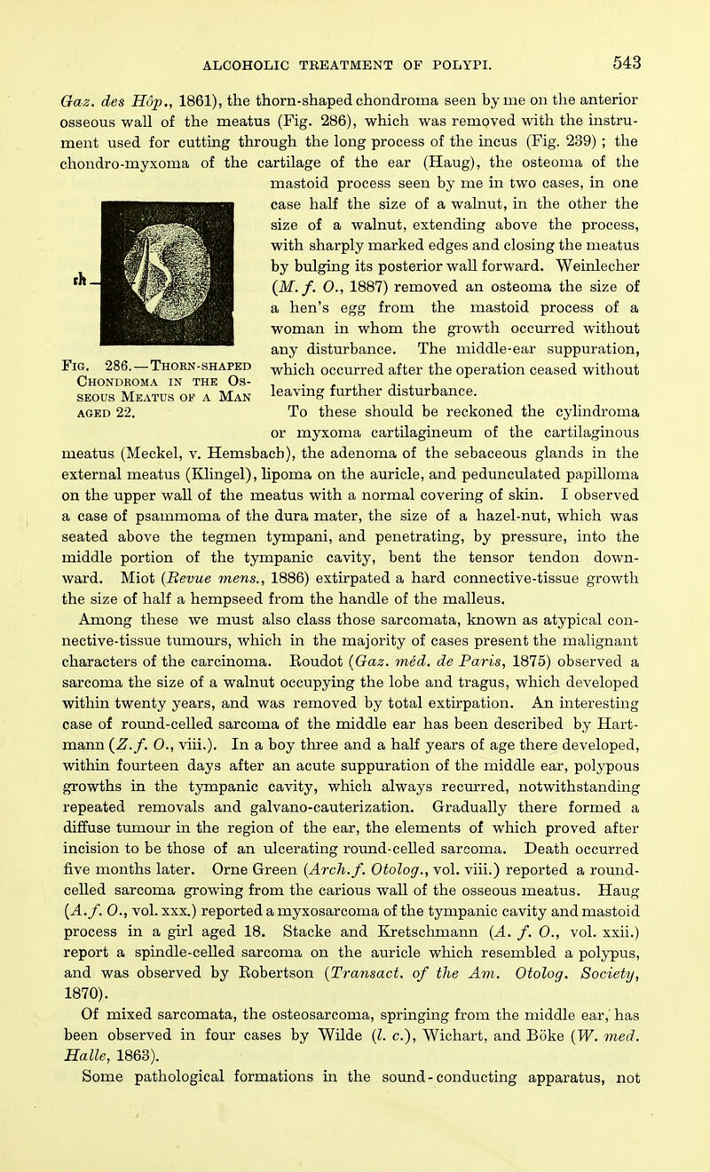 Oaz. des Hop., 1861), the thorn-shaped chondroma seen by me on the anterior osseous wall of the meatus (Fig. 286), which was removed with the instru- ment used for cutting through the long process of the incus (Fig. 239) ; the chondro-myxoma of the cartilage of the ear (Haug), the osteoma of the mastoid process seen by me in two cases, in one case half the size of a walnut, in the other the size of a walnut, extending above the process, with sharply marked edges and closing the meatus by bulging its posterior wall forward. Weinlecher (M.f. 0., 1887) removed an osteoma the size of a hen's egg from the mastoid process of a woman in whom the growth occurred without any disturbance. The middle-ear suppuration, Fig. 286.—Thorn-shapkd -which occurred after the operation ceased without Chondroma in the Os- , . , t. , , SKOus Meatus of a Man leaving further disturbance. AGED 22. To these should be reckoned the cylindroma or myxoma cartUagineum of the cartilaginous meatus (Meckel, v. Hemsbach), the adenoma of the sebaceous glands in the external meatus (Klingel), lipoma on the auricle, and pedunculated papilloma on the upper wall of the meatus with a normal covering of skin. I observed a case of psammoma of the dura mater, the size of a hazel-nut, which was seated above the tegmen tympani, and penetrating, by pressure, into the middle portion of the tympanic cavity, bent the tensor tendon down- ward. Miot (Bevue mens., 1886) extirpated a hard connective-tissue growth the size of half a hempseed from the handle of the malleus. Among these we must also class those sarcomata, known as atypical con- nective-tissue tumours, which in the majority of cases present the malignant characters of the carcinoma. Roudot (Gaz. med. de Paris, 1875) observed a sarcoma the size of a walnut occupying the lobe and tragus, which developed within twenty years, and was removed by total extirpation. An interesting case of round-celled sarcoma of the middle ear has been described by Hart- mann {Z.f, 0., viii.). In a boy three and a half years of age there developed, within fourteen days after an acute suppuration of the middle ear, polypous growths in the tympanic cavity, which always recurred, notwithstanding repeated removals and galvano-cauterization. Gradually there formed a diffuse tumour in the region of the ear, the elements of which proved after incision to be those of an ulcerating round-celled sarcoma. Death occurred five months later. Orne Green (Arch.f. Otolog., vol. viii.) reported a round- celled sarcoma growing from the carious wall of the osseous meatus. Haug {A.f. 0., vol. XXX.) reported a myxosarcoma of the tympanic cavity and mastoid process in a girl aged 18. Stacke and Kretschmann {A. f. 0., vol. xxii.) report a spindle-celled sarcoma on the auricle which resembled a polypus, and was observed by Robertson {Transact, of the Am. Otolog. Society, 1870). Of mixed sarcomata, the osteosarcoma, springing from the middle ear,' has been observed in four cases by Wilde {I. c), Wichart, and Boke (W. med. Halle, 1863). Some pathological formations in the sound - conducting apparatus, not