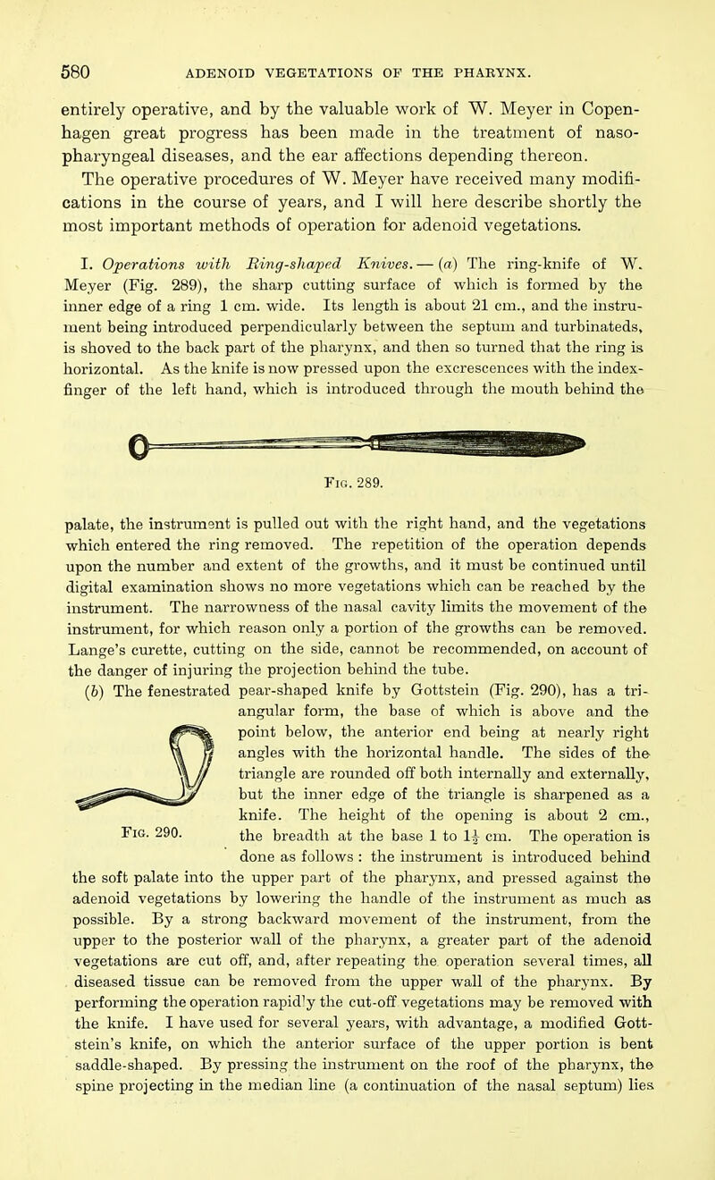 entirely operative, and by the valuable work of W. Meyer in Copen- hagen great progress has been made in the treatment of naso- pharyngeal diseases, and the ear affections depending thereon. The operative procedures of W. Meyer have received many modifi- cations in the course of years, and I will here describe shortly the most important methods of operation for adenoid vegetations. I. Operations with Eing-shaped Knives. — (n) The ring-knife of W. Meyer (Fig. 289), the sharp cutting surface of which is formed by the inner edge of a ring 1 cm. wide. Its length is about 21 cm., and the instru- ment being introduced perpendicularly between the septum and turbinateds, is shoved to the back part of the pharynx, and then so turned that the ring is horizontal. As the knife is now pressed upon the excrescences with the index- finger of the left hand, which is introduced through the mouth behind the Fig. 289. palate, the instrument is pulled out with the rin;ht hand, and the vegetations which entered the ring removed. The repetition of the operation depends upon the number and extent of the growths, and it must be continued until digital examination shows no more vegetations which can be reached by the instrument. The narrowness of the nasal cavity limits the movement of the instrument, for which reason only a portion of the growths can be removed. Lange's curette, cutting on the side, cannot be recommended, on account of the danger of injuring the projection behind the tube. (6) The fenestrated pear-shaped knife by Gottstein (Fig. 290), has a tri- angular form, the base of which is above and the l^fe. point below, the anterior end being at nearly right angles with the horizontal handle. The sides of the triangle are rounded off both internally and externally, but the inner edge of the triangle is sharpened as a knife. The height of the opening is about 2 cm., the breadth at the base 1 to li cm. The operation is done as follows : the instrument is introduced behind the soft palate into the upper part of the pharynx, and pressed against the adenoid vegetations by lowering the handle of the instrument as much as possible. By a strong backward movement of the instrument, from the upper to the posterior wall of the pharynx, a greater part of the adenoid vegetations are cut off, and, after repeating the. operation several times, all diseased tissue can be removed from the upper wall of the pharynx. By performing the operation rapidly the cut-off vegetations may be removed with the knife. I have used for several years, with advantage, a modified Gott- stein's knife, on which the anterior surface of the upper portion is bent saddle-shaped. By pressing the instrument on the roof of the pharynx, the spine projecting in the median line (a continuation of the nasal septum) lies