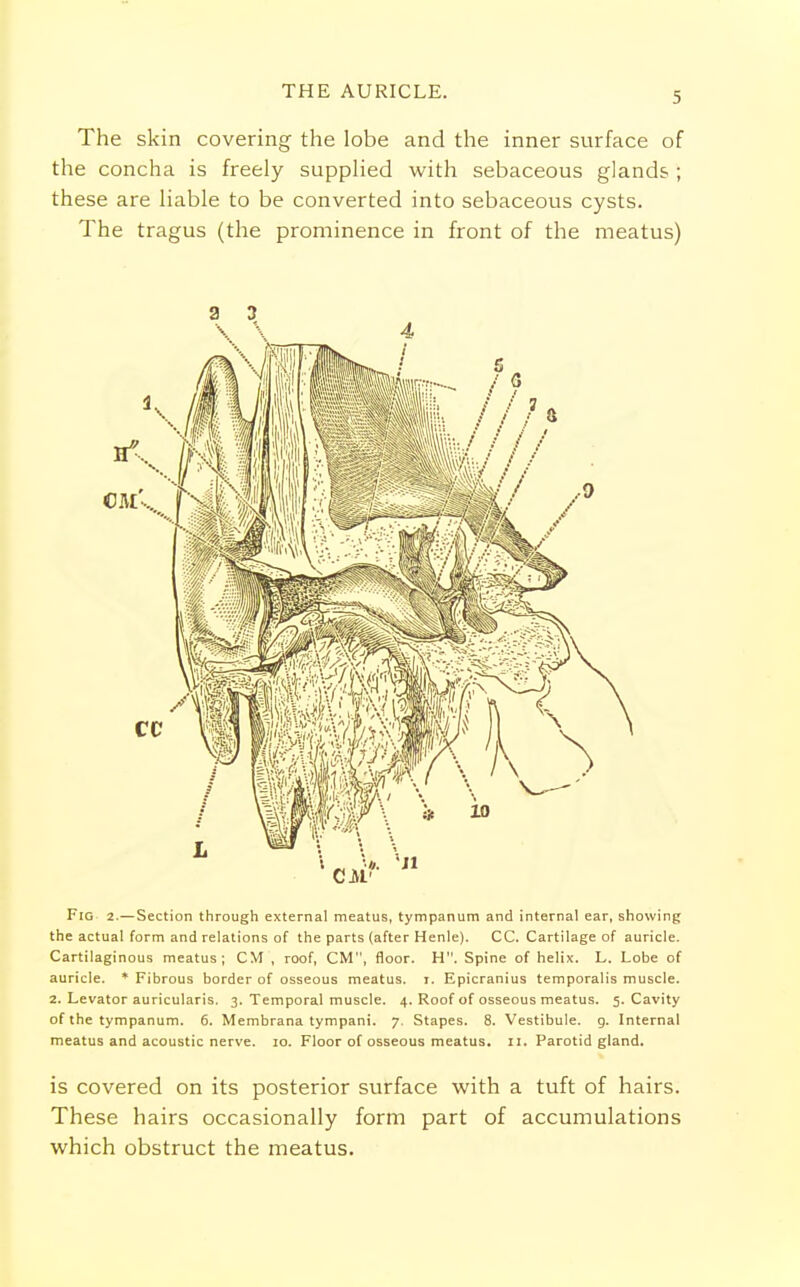 THE AURICLE. The skin covering the lobe and the inner surface of the concha is freely supplied with sebaceous glands ; these are liable to be converted into sebaceous cysts. The tragus (the prominence in front of the meatus) a a V \ 4 Fig 2.—Section through external meatus, tympanum and internal ear, showing the actual form and relations of the parts (after Henle). CC. Cartilage of auricle. Cartilaginous meatus; CM , roof, CM, floor. H. Spine of helix. L. Lobe of auricle. * Fibrous border of osseous meatus, r. Epicranius temporalis muscle. 2. Levator auricularis. 3. Temporal muscle. 4. Roof of osseous meatus. 5. Cavity of the tympanum. 6. Membrana tympani. 7. Stapes. 8. Vestibule, g. Internal meatus and acoustic nerve. 10. Floor of osseous meatus. 11. Parotid gland. is covered on its posterior surface with a tuft of hairs. These hairs occasionally form part of accumulations which obstruct the meatus.