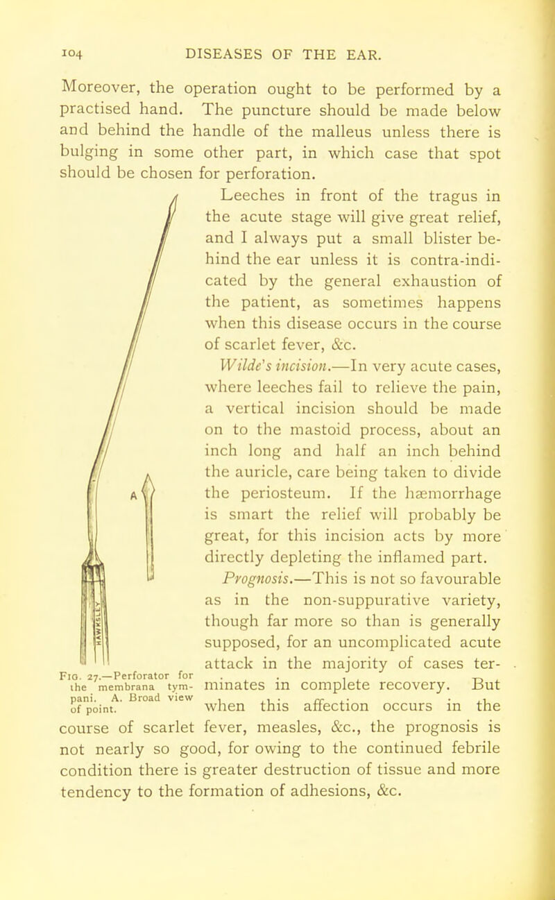 Moreover, the operation ought to be performed by a practised hand. The puncture should be made below and behind the handle of the malleus unless there is bulging in some other part, in which case that spot should be chosen for perforation. Leeches in front of the tragus in the acute stage will give great relief, and I always put a small blister be- hind the ear unless it is contra-indi- cated by the general exhaustion of the patient, as sometimes happens when this disease occurs in the course of scarlet fever, &c. Wilde's incision.—In very acute cases, where leeches fail to relieve the pain, a vertical incision should be made on to the mastoid process, about an inch long and half an inch behind the auricle, care being taken to divide the periosteum. If the haemorrhage is smart the relief will probably be great, for this incision acts by more directly depleting the inflamed part. Prognosis.—This is not so favourable as in the non-suppurative variety, though far more so than is generally supposed, for an uncomplicated acute attack in the majority of cases ter- Fio. 27.—Perforator for . the membrana tym- inmates in complete recovery. .But pani. A. Broad view , ,. ~. . , of point. when this affection occurs in the course of scarlet fever, measles, &c, the prognosis is not nearly so good, for owing to the continued febrile condition there is greater destruction of tissue and more tendency to the formation of adhesions, &c.