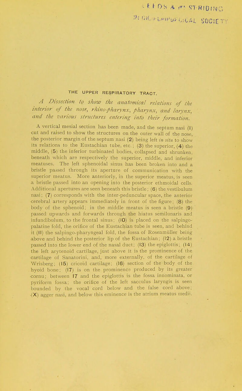 • i ♦ OS A S'Tf KlDflvj.;', THE UPPER RESPIRATORY TRACT. A Dissection to show the anatomical relations of the interior of the nose, rhino-pharynx, pharynx, and larynx, and the various structures entering info their formation. A vertical mesial section has been made, and the septum nasi (!) cut and raised to show the structures on the outer wall of the nose, the posterior margin of the septum nasi (2) being left in situ to show its relations to the Eustachian tube, etc.; (3) the superior, (4) the middle, (5) the inferior turbinated bodies, collapsed and shrunken, beneath which ar's respectively the superior, middle, and inferior meatuses. The left sphenoidal sinus has been broken into and a bristle passed through its aperture of communication with the superior meatus. More anteriorly, in the superior meatus, is seen a bristle passed into an opening into the posterior ethmoidal cells. Additional apertures are seen beneath this bristle; (6) the vestibulum nasi; (7) corresponds with the inter-peduncular space, the anterior cerebral artery appears immediately in front of the figure; (8) the body of the sphenoid; in the middle meatus is seen a bristle (9) passed upwards and forwards through the hiatus semilunaris and infundibulum, to the frontal sinus; (10) is placed on the salpingo- palatine fold, the orifice of the Eustachian tube is seen, and behind it (II) the salpingo-pharyngeal fold, the fossa of Rosenmiiller being above and behind the posterior lip of the Eustachian ; (12) a bristle passed into the lower end of the nasal duct; (13) the epiglottis; (14) the left arytenoid cartilage, just above it is the prominence of the cartilage of Sanatorini, and, more externally, of the cartilage of Wrisberg; (15) cricoid cartilage; (16) section of the body of the hyoid bone; (17) is on the prominence produced by its greater cornu; between 17 and the epiglottis is the fossa innominata, or pyriform fossa; the orifice of the left sacculus laryngis is seen bounded by the vocal cord below and the false cord above; .(X) agger nasi, and below this eminence is the atrium meatus medii.