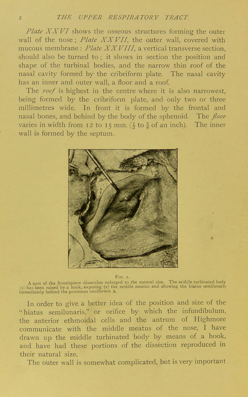 Plate XX VI shows the osseous structures forming the outer wall of the nose; Plate XXVII, the outer wall, covered with mucous membrane : Plate XXVIII a vertical transverse section, should also be turned to ; it shows in section the position and shape of the turbinal bodies, and the narrow thin roof of the nasal cavity formed by the cribriform plate. The nasal cavity has an inner and outer wall, a floor and a roof. The roof is highest in the centre where it is also narrowest, being formed by the cribriform plate, and only two or three millimetres wide. In front it is formed by the frontal and nasal bones, and behind by the body of the sphenoid. The floor varies in width from 12 to 15 mm. to | of an inch). The inner wall is formed by the septum. 1''|G. I. .A part of the frontispiece dissection enlarged to the natural size. The middle turbinated body fi) has been raised by a hook, exposing (2) the middle meatus and showing the hiatus semilunaris immediately behind the processus iniciformis X. In order to give a better idea of the position and size of the hiatus semilunaris, or orifice by which the infundibulum, the anterior ethmoidal cells and the antrum of Highmore communicate with the middle meatus of the nose, I have drawn up the middle turbinated body by means of a hook, and have had these portions of the dissection reproduced in their natural size. The outer wall is somewhat complicated, but is very important