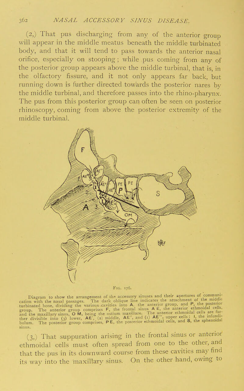 (2,) That pus dischargin<;- from any of the anterior group will appear in the middle meatus beneath the middle turbinated body, and that it will tend to pass towards the anterior nasal orifice, especially on stooping ; while pus coming from any of the posterior group appears above the middle turbinal, that is, in the olfactory fissure, and it not onlj^ appears far back, but running down is further directed towards the posterior nares by the middle turbinal, and therefore passes into the rhino-pharynx. The pus from this posterior group can often be seen on posterior rhinoscop)', coming from above the posterior extremity of the middle turbinal. Fig. 176. DiaRvam to show the arrangement of ths accessory sinnses and their apertures of communi- ion with the nasal passages. The dark oblique hne indicates the attachment of the middle turbinated bone, dividing the various cavities into A. the anienur group, and P, the Pos''0' group. The anterior group comprises F, the frontal suius A E, the anterior e hmoidal ce s, and The ma.xillary sinus, O M, being the ostium .nax.llaie. I he anterior ethmoida cells are fu - ther divisible inio (3) lower, AE', (2I middle, AE, and (i) AE ', upper cells ■ >e^'nf^d. biilum. The posterior group comprises, P E, the posterior ethmoidal cells, and S, the sphenoidal sintis. (3,) That suppuration arising in the frontal sinus or anterior ethmoidal cells must often spread from one to the other, and that the pus in its downward course from these cavities may find its way into the maxillary sinus. On the other hand, owing to