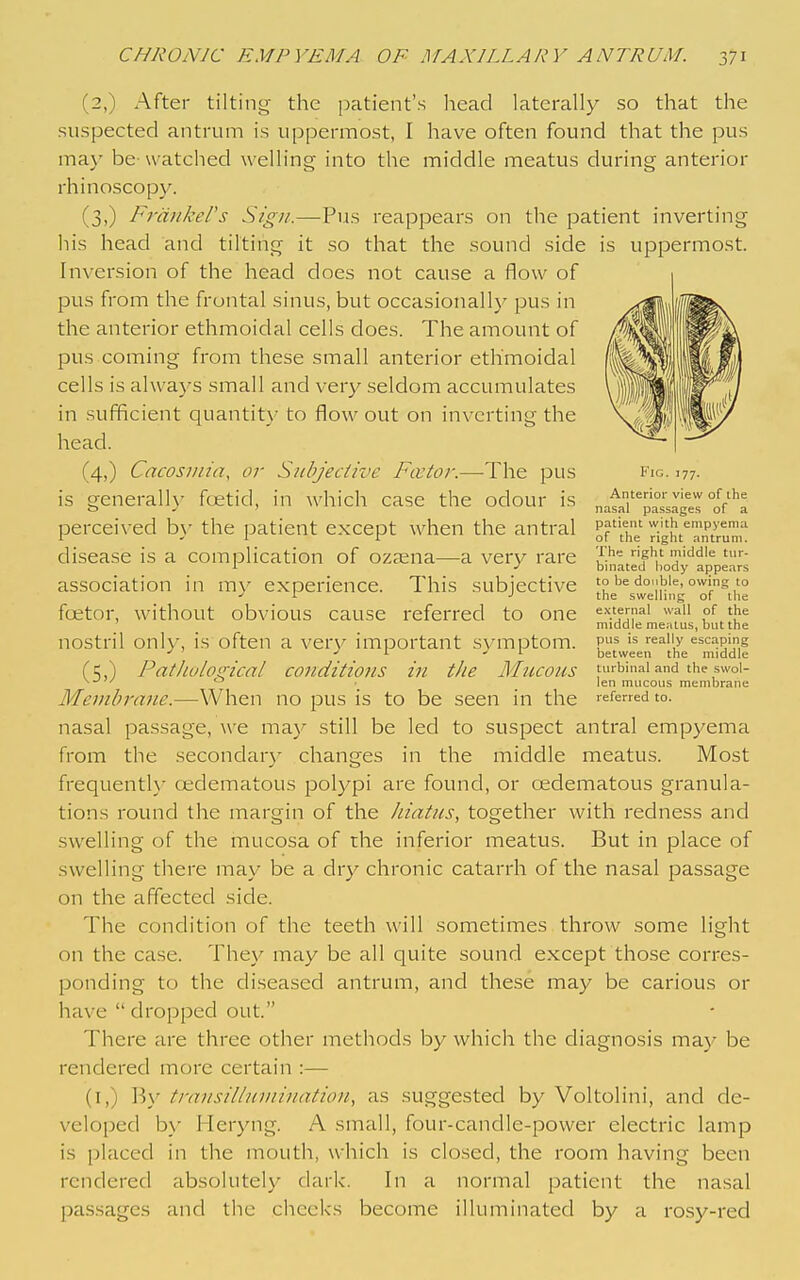 (2,) After tilting the patient's liead laterally so that the suspected antrum is uppermost, I have often found that the pus ma\' be watched welling into the middle meatus during anterior rhinoscopj^ (3,) Frankers Sign.—Pus reappears on the patient inverting his head and tilting it so that the sound side is uppermost. Inversion of the head does not cause a flow of pus from the frontal sinus, but occasionally pus in the anterior ethmoidal cells does. The amount of pus coming from these small anterior ethmoidal cells is always small and very seldom accumulates in sufficient quantity to flow out on inverting the head. (4,) Cacosiin'a, or Subjective Fcctor.—-The pus is generalh' foetid, in which case the odour is perceived b}- the patient except when the antral disease is a complication of oza^na—a very rare association in m}^ experience. This subjective foetor, without obvious cause referred to one nostril only, is often a very important symptom. (5,) Pat I 10 logical conditions iti the Mucous Membrane.—When no pus is to be seen in the nasal passage, we may still be led to suspect antral empyema from the secondar}^ changes in the middle meatus. Most frequenth- cedematous polypi are found, or oedematous granula- tions round the margin of the hiatus, together with redness and swelling of the mucosa of the inferior meatus. But in place of swelling there may be a dry chronic catarrh of the nasal passage on the affected side. The condition of the teeth will sometimes throw some light on the case. They may be all quite sound except those corres- ponding to the diseased antrum, and these may be carious or have  dropped out. There are three other methods by which the diagnosis may be rendered more certain :— (I,) By transilluniination, as suggested by Voltolini, and de- veloped b>' Heryng. A small, four-candle-power electric lamp is placed in the mouth, which is closed, the room having been rendered absolutely dark. In a normal patient the nasal passages and the checks become illuminated by a rosy-red Fig. 177. Anterior view of the nasal passages of a patient with empyema of the right antrum. The right middle tur- binated liody appears to be double, owing to the swelling of the e.\ternal wall of the middle meatus, but the pus is really escaping between the middle turbinal and the swol- len mucous membrane referred to.