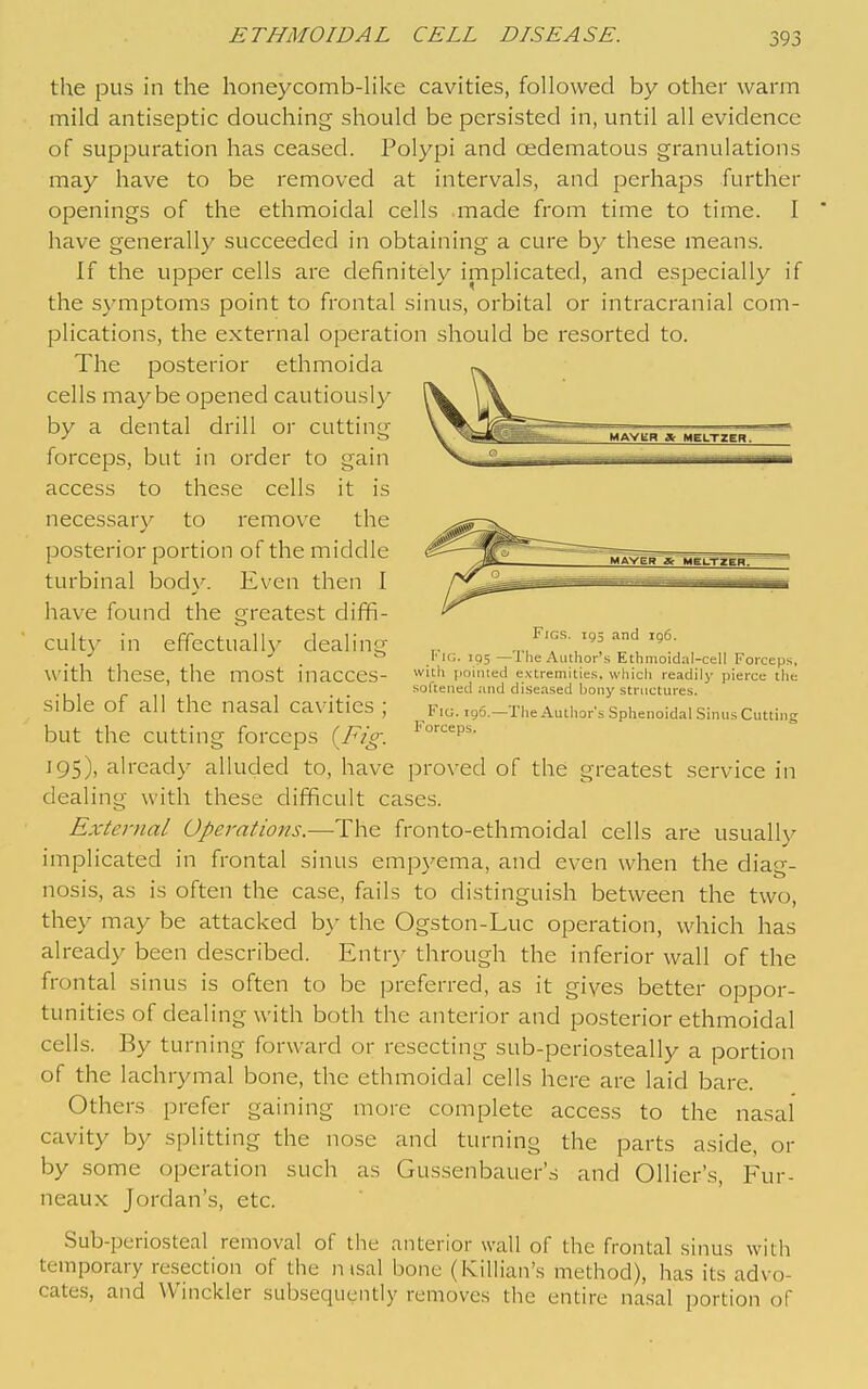 the pus in the honeycomb-hke cavities, followed by other warm mild antiseptic douching should be persisted in, until all evidence of suppuration has ceased. Polypi and oedematous granulations may have to be removed at intervals, and perhaps further openings of the ethmoidal cells made from time to time. I ' have generally succeeded in obtaining a cure by these means. If the upper cells are definitely implicated, and especially if the symptoms point to frontal sinus, orbital or intracranial com- plications, the external operation should be resorted to. The posterior ethmoida cells maybe opened cautiously by a dental drill or cutting forceps, but in order to gain access to these cells it is necessary to remove the posterior portion of the middle turbinal body. Even then I have found the greatest diffi- culty in effcctuall)^ dealing with these, the most inacces- sible of all the nasal cavities ; but the cutting forceps i^Fig. 195), already alluded to, have proved of the greatest service in dealing with these difficult cases. External Operations.—The fronto-ethmoidal cells are usually implicated in frontal sinus empyema, and even when the diag- nosis, as is often the case, fails to distinguish between the two, they may be attacked by the Ogston-Luc operation, which has already been described. Entry through the inferior wall of the frontal sinus is often to be preferred, as it gives better oppor- tunities of dealing with both the anterior and posterior ethmoidal cells. By turning forward or resecting sub-periosteally a portion of the lachrymal bone, the ethmoidal cells here are laid bare. Others prefer gaining more complete access to the nasal cavity by splitting the nose and turning the parts aside, or by some operation such as Gussenbauer's and Ollier's, Fur- neaux Jordan's, etc. Sub-pcriosteal removal of the anterior wall of the frontal sinus witli temporary resection of the nisal bone (Killian's method), has its advo- cates, and VVinckler subsequently removes the entire nasal portion of Figs. 195 and 106. I''u;. 195 —The Author's Ethmoidai-cell Forceps, with pointed extremities, which readily pierce tlie .softened and diseased bony structures. Fig. 196.—The Author's Sphenoidal Sinus Cutting Forceps.