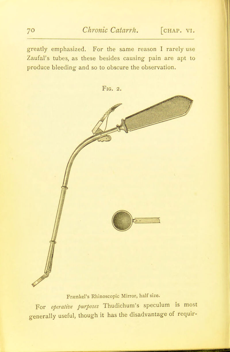 greatly emphasized. For the same reason I rarely use Zaufal's tubes, as these besides causing- pain are apt to produce bleeding and so to obscure the observation. Fig. 2. Frsenkel's Rhinoscopic Mirror, half size. For operative purposes Thudichum's speculum is most generally useful, though it has the disadvantage of requir-