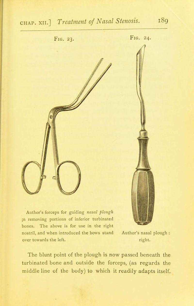 Fig. 23. Author's forceps for guiding nasal plough jn removing portions of inferior turbinated bones. The above is for use in the right nostril, and when introduced the bows stand over towards the left. Fig. 24. Author's nasal plough ; right. The blunt point of the plough is now passed beneath the turbinated bone and outside the forceps, (as regards the middle line of the body) to which it readily adapts itself.