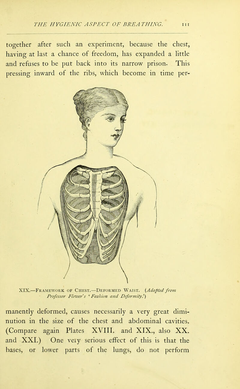 together after such an experiment, because the chest, having at last a chance of freedom, has expanded a httle and refuses to be put back into its narrow prison. This pressing inward of the ribs, which become in time per- XIX.—Framework of Chest.—Deformed Waist. [Adapted from Professor Flower s ' Fashion and Deformity.^) manently deformed, causes necessarily a very great dimi- nution in the size of the chest and abdominal cavities. (Compare again Plates XVIII. and XIX., also XX. and XXL) One very serious effect of this is that the bases, or lower parts of the lungs, do not perform