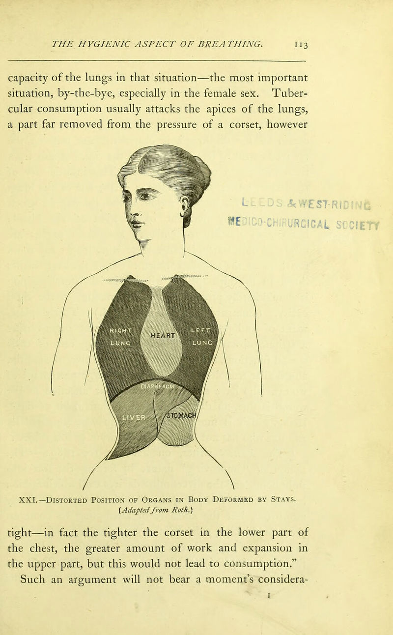 capacity of the lungs in that situation—the most important situation, by-the-bye, especially in the female sex. Tuber- cular consumption usually attacks the apices of the lungs, a part far removed from the pressure of a corset, however XXI.—Distorted Position of Organs in Body Deformed by Stays. {^Adaptedfrom Roth.) tight—in fact the tighter the corset in the lower part of the chest, the greater amount of work and expansion in the upper part, but this would not lead to consumption. Such an argument will not bear a moment's considera- I