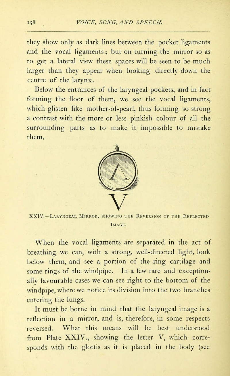 they show only as dark Hnes between the pocket hgaments and the vocal ligaments; but on turning the mirror so as to get a lateral view these spaces will be seen to be much larger than they appear when looking directly down the centre of the larynx. Below the entrances of the laryngeal pockets, and in fact forming the floor of them, we see the vocal ligaments, which glisten like mother-of-pearl, thus forming so strong a contrast with the more or less pinkish colour of all the surrounding parts as to make it impossible to mistake them. V XXIV.—Laryngeal Mirror, showing the Reversion of the Reflected Image. When the vocal ligaments are separated in the act of breathing we can, with a strong, well-directed light, look below them, and see a portion of the ring cartilage and some rings of the windpipe. In a few rare and exception- ally favourable cases we can see right to the bottom of the windpipe, where we notice its division into the two branches entering the lungs. It must be borne in mind that the laryngeal image is a reflection in a mirror, and is, therefore, in some respects reversed. What this means will be best understood from Plate XXIV., showing the letter V, which corre- sponds with the glottis as it is placed in the body (see