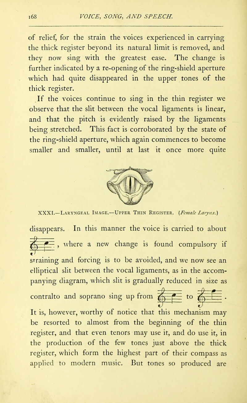 of relief, for the strain the voices experienced in carrying the thick register beyond its natural limit is removed, and they now sing with the greatest ease. The change is further indicated by a re-opening of the ring-shield aperture which had quite disappeared in the upper tones of the thick register. If the voices continue to sing in the thin register we observe that the slit between the vocal ligaments is linear, and that the pitch is evidently raised by the ligaments being stretched. This fact is corroborated by the state of the ring-shield aperture, which again commences to become smaller and smaller, until at last it once more quite XXXI.—Laryngeal Image.—Upper Thin Register. (Female Laiyux.) disappears. In this manner the voice is carried to about , Avhere a new change is found compulsory if straining and forcing is to be avoided, and we now see an elliptical slit between the vocal ligaments, as in the accom- panying diagram, which slit is gradually reduced in size as contralto and soprano sing up from It is, however, worthy of notice that this mechanism may be resorted to almost from the beginning of the thin register, and that even tenors may use it, and do use it, in the production of the few tones just above the thick register, which form the highest part of their compass as applied to modern music. But tones so produced are