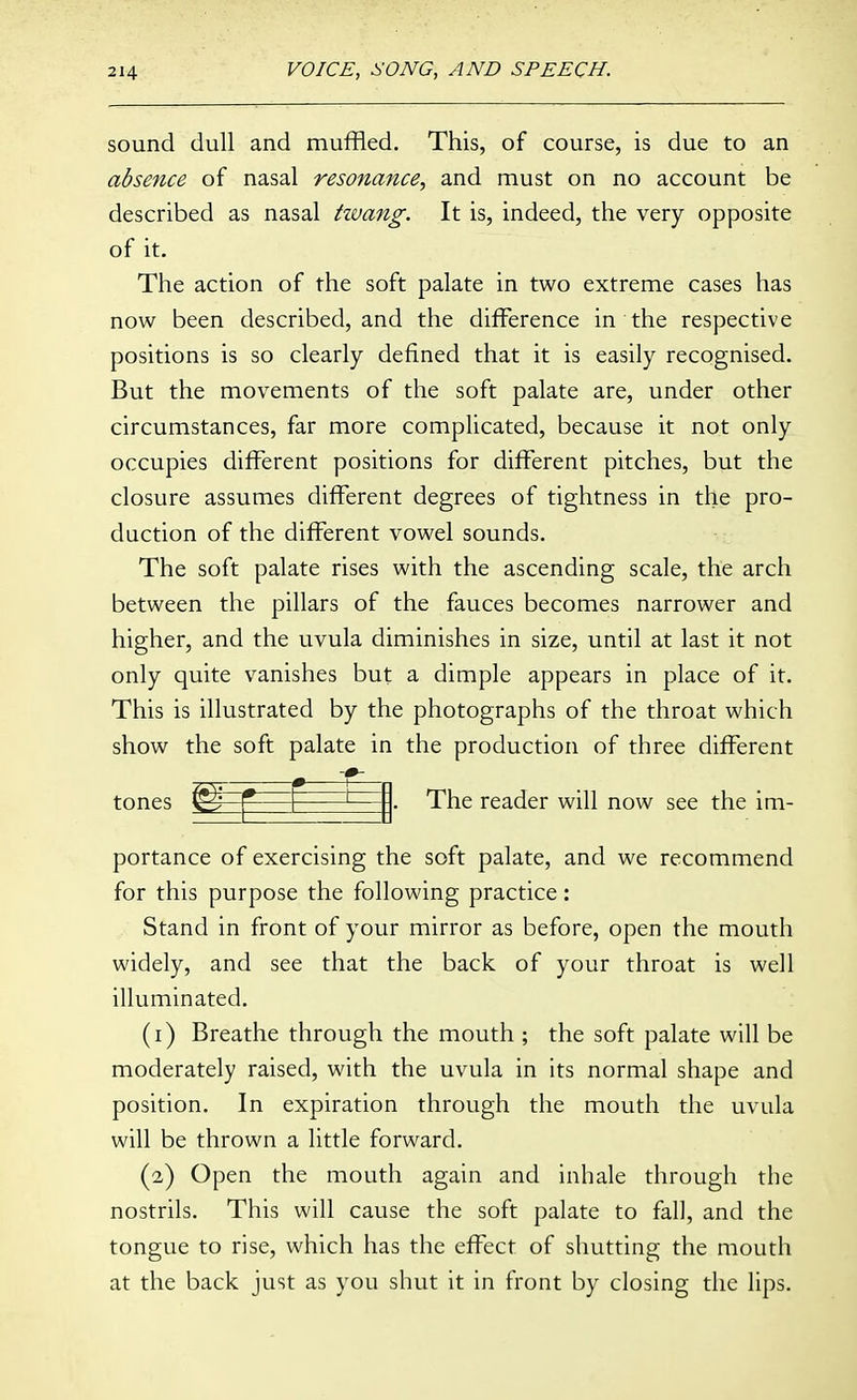 sound dull and muffled. This, of course, is due to an absence of nasal resonance, and must on no account be described as nasal tivang. It is, indeed, the very opposite of it. The action of the soft palate in two extreme cases has now been described, and the difference in the respective positions is so clearly defined that it is easily recognised. But the movements of the soft palate are, under other circumstances, far more complicated, because it not only occupies different positions for different pitches, but the closure assumes different degrees of tightness in the pro- duction of the different vowel sounds. The soft palate rises with the ascending scale, the arch between the pillars of the fauces becomes narrower and higher, and the uvula diminishes in size, until at last it not only quite vanishes but a dimple appears in place of it. This is illustrated by the photographs of the throat which show the soft palate in the production of three different S5r_= — tones ^ I ' -. The reader will now see the im- portance of exercising the soft palate, and we recommend for this purpose the following practice: Stand in front of your mirror as before, open the mouth widely, and see that the back of your throat is well illuminated. (1) Breathe through the mouth ; the soft palate will be moderately raised, with the uvula in its normal shape and position. In expiration through the mouth the uvula will be thrown a little forward. (2) Open the mouth again and inhale through the nostrils. This will cause the soft palate to fall, and the tongue to rise, which has the effect of shutting the mouth at the back just as you shut it in front by closing the lips.