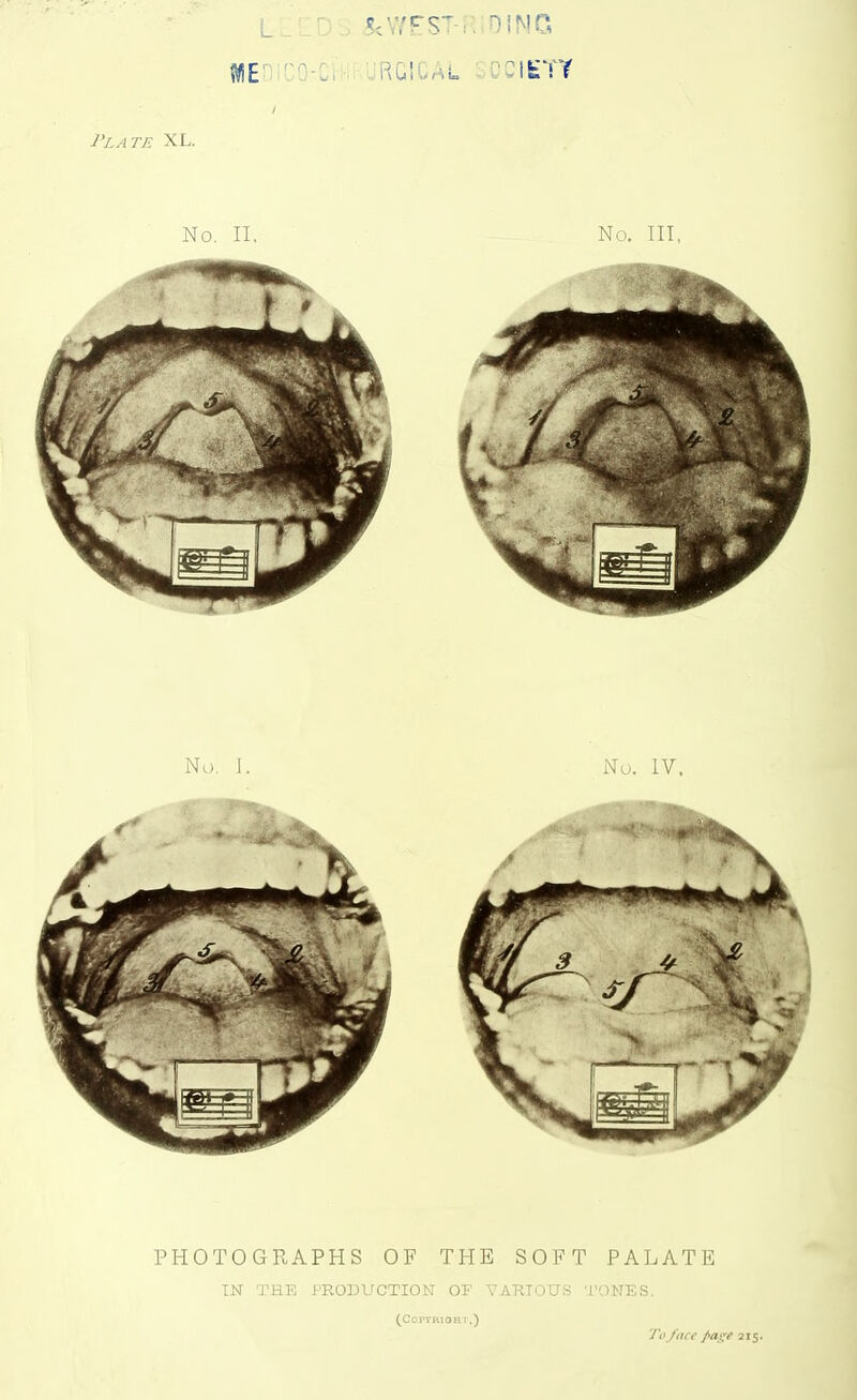 fWEHi ?<WFST-R;OiMG 7'/.^ 7-^ XL. No. II. No. Ill, No. I. No. IV. PHOTOGRAPHS OF THE SOFT PALATE IN THE PRODUCTION OF VARIOUS 'J'ONES. (CopyRlOH 1.) To/ace page 215
