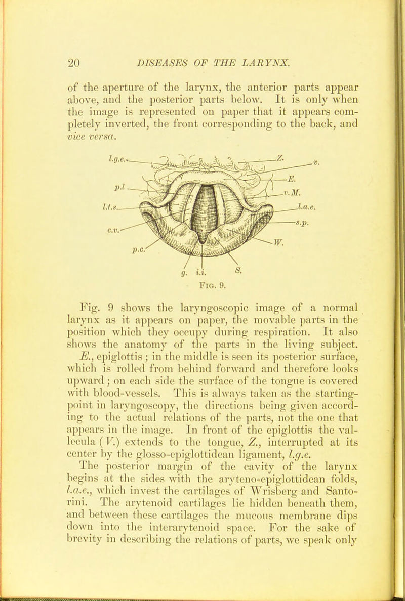 of the aperture of the larynx, the anterior parts appear above, and the posterior parts below. It is only when the image is represented on paper that it appears com- pletely inverted, the front corresponding to the back, and vice verm. Fig. 9. Fig. 9 shows the laryngoscopic image of a normal larynx as it appears on paper, the movable parts in the position which they occupy during respiration. It also shows the anatomy of the parts in the living subject. E., epiglottis ; in the middle is seen its posterior surface, which is rolled from behind forward and therefore looks upward ; on each side the surface of the tongue is covered with blood-vessels. This is always taken as the starting- point in laryngoscopy, the directions being given accord- ing to the actual relations of the parts, not the one that appears in the image. In front of the epiglottis the val- lecula (V.) extends to the tongue, Z., interrupted at its center by the glosso-epiglottidean ligament, l.g.e. The posterior margin of the cavity of the larynx begins at the sides with the aryteno-epiglottidean folds, Lax., which invest the cartilages of Wrisberg and Santo- rini. The arytenoid cartilages lie hidden beneath them, and between these cartilages the mucous membrane dips down into the interarytenoid space. For the sake of brevity in describing the relations of parts, we speak only