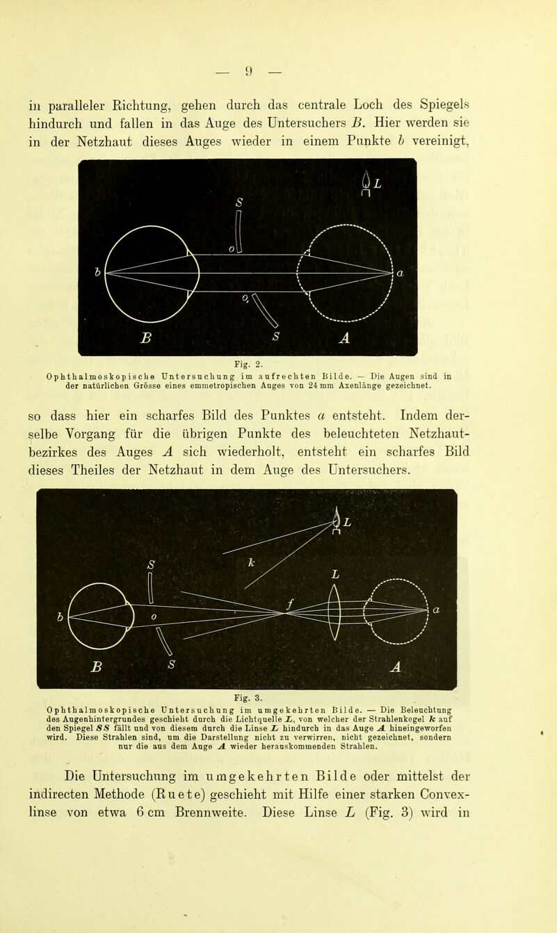 in paralleler Richtung, gehen durch das centrale Loch des SpiegeLs hindurch und fallen in das Auge des Untersuchers B. Hier werden sie in der Netzhaut dieses Auges wieder in einem Punkte b vereinigt, Fig. 2. Ophthalmoskopisclie Untersuchung im aufrechten Bilde. — Die Aiigen sind in der naturlichen Grosse eines emmetropischen Auges von 24 mm Aienlange gezeichnet. SO dass hier ein scharfes Bild des Punktes a entsteht. Indem der- seltae Vorgang fiir die iibrigen Punkte des beleuchteten Netzhaut- bezirkes des Auges A sich wiederholt, entsteht ein scharfes Bild dieses Theiles der Netzhaut in dem Auge des Untersuchers. s ^ X n X L B s . A Fig. 3. Ophthalmoskopisclie Untersuchun g im umgekehrten Bilde. — Die Beleachtnng des Angenhintergrundes geschieht dnrch die Lichtquelle i, von welcher der Strahlenkegel fc auf den Spiegel 5S fallt nnd von diesem durch die Linse L hiudarch in das Auge A. hineingeworfeu wird. Diese Strahlen sind, um die Darstellung nicht zu verwirreii, nicht gezeichnet, sondern nnr die aus dem Auge A. wieder her.mskommenden Strahlen. Die Untersuchung im umgekehrten Bilde oder mittelst der indirecten Methode (Ruete) geschieht mit Hilfe einer starken Convex- linse von etwa 6 cm Brennweite. Diese Linse L (Fig. 3) wird in