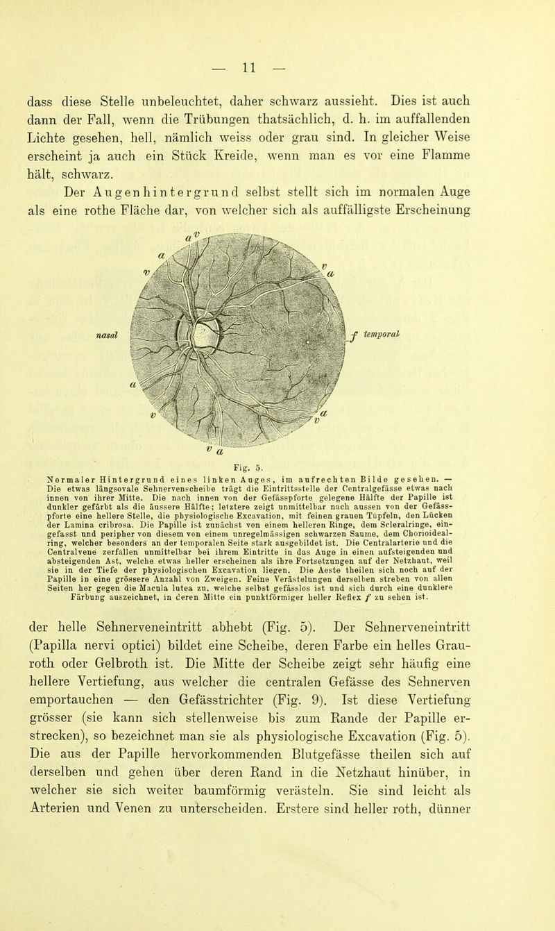 dass diese Stelle unbeleuchtet, daher schwarz aussieht. Dies ist auch dann der Fall, wenn die Triibungen thatsachlich, d. h. im auffallenden Lichte gesehen, hell, naralich weiss oder grau sind. In gleicher Weise erscheint ja auch ein Stiick Kreide, wenn man es vor eine Flamme halt, schwarz. Der Augenhintergrund selbst stellt sich im normalen Auge als eine rothe Flache dar, von welcher sich als auffalligste Erscheinung temporal Fig. 5. Normaler Hintergrund eines linken Anges, im anfrechten Bilde gesehen. — Die etwas langsovale Sehnervenpcheibe tragt die Eintrittsstelle der Centralgefasse etwas nacli innen von ihrer Mitte. Die nach innen von der Gefasspforte gelegene Halfte der Papille ist dnnkler gefarbt als die aussere Halfte; lelztere zeigt nnmittelbar nach anssen von der Gefass- pforte eine hellere Stelle, die physiologisclie Excavation, mit feinen granen Tupfeln, den Lucken der Lamina cribrosa. Die Papille ist znnachst von einem helleren Binge, dem Soleralringe, ein- gefasst nnd peripher von diesem von einem nnregelmassigen schvfarzen Sanme, dem Cborioideal- ring, welcher besonders an der temporalen Seite stark ansgebildet ist. Die Centralarterie nnd die Centralvene zerfallen nnmittelbar bei ihrem Eintritte in das Ange in einen aufsteigenden nnd absteigenden Ast, welche etwas heller erscheinen als ihre Fortsetznngen anf der Netzhant, weil sie in der Tiefe der physiologischen Excavation liegen. Die Aeste theilen sich noch anf der Papille in eine grossere Anzahl von Zweigen. Peine Verastelungen derselben streben von alien Seiten her gegen die Macnia Intea zn. welcbe selbst gefasslos ist nnd sich dnrch eine dnnklere Farbung auszeichnet, in deren Mitte ein pnnktformiger heller Keflex / zn sehen ist. der helle Sehnerveneintritt abhebt (Fig. 5). Der Sehnerveneintritt (Papilla nervi optici) bildet eine Scheibe, deren Farbe ein helles Grau- roth oder Gelbroth ist. Die Mitte der Scheibe zeigt sehr haufig eine hellere Vertiefung, aus welcher die centralen Gefasse des Sehnerven emportauchen — den Gefasstrichter (Fig. 9). Ist diese Vertiefung grosser (sie kann sich stellenweise bis zum Rande der Papille er- strecken), so bezeichnet man sie als physiologische Excavation (Fig. 5). Die aus der Papille hervorkommenden Blutgefasse theilen sich auf derselben und gehen itber deren Rand in die Netzhaut hiniiber, in welcher sie sich weiter baumformig verasteln. Sie sind leicht als Arterien und Venen zu unterscheiden. Erstere sind heller roth, diinner