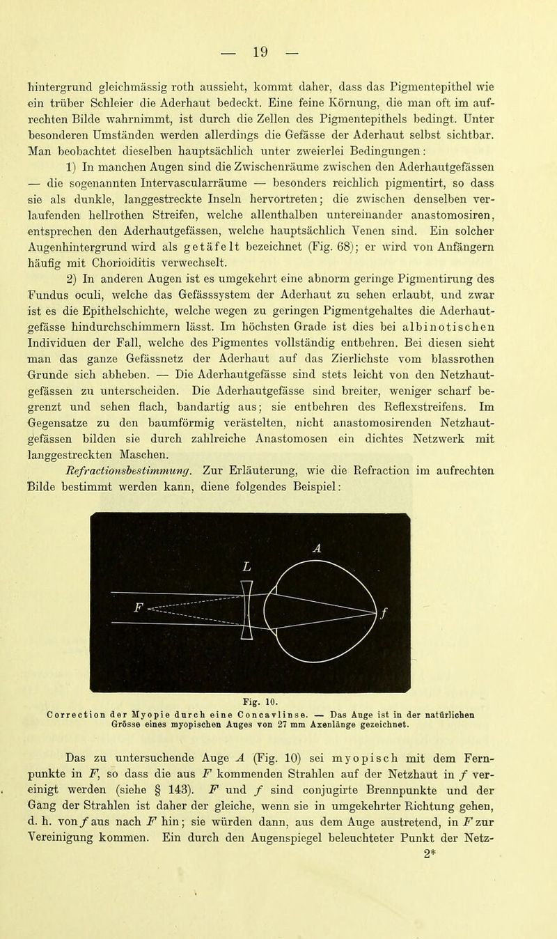 hintergrund gleichmassig roth aussieht, kommt daher, dass das Pigmentepithel wie ein triiber Schleier die Aderhaut bedeckt. Eine feine Kornung, die man oft im auf- rechten Bilde wahrnimmt, ist durch die Zellen des Pigmentepithels bedingt. Enter besonderen Umstanden werden allerdings die Gefasse der Aderhaut selbst sichtbar. Man beobachtet dieselben hauptsachlich unter zweierlei Bedingungen: 1) In manchen Augen sind die Zwischenraume zwischen den Aderhautgefassen — die sogenannten Intervascularraume — besonders reichlich pigmentirt, so dass sie als dunkle, langgestreckte Inseln hervortreten; die zwischen denselben ver- laufenden hellrothen Streifen, welche allenthalben nntereinander anastomosiren, entsprechen den Aderhautgefassen, welche hauptsachlich Venen sind. Ein solcher Augenhintergrund wird als getafelt bezeichnet (Fig. 68); er wird von Anfiingern hiiufig mit Chorioiditis verwechselt. 2) In anderen Augen ist es umgekehrt eine abnorm geringe Pigmentirung des Fundus oculi, welche das Gefasssystem der Aderhaut zu sehen erlaubt, und zwar ist es die Epithelschichte, welche wegen zu geringen Pigmentgehaltes die Aderhaut- gefasse hindurchschimmern lasst. Im hochsten Grade ist dies bei albinotischen Individuen der Fall, welche des Pigmentes vollstandig entbehren. Bei diesen sieht man das ganze Gefassnetz der Aderhaut auf das Zierlichste vom blassrothen Grunde sich abheben. — Die Aderhautgefasse sind stets leicht von den Netzhaut- gefassen zu unterscheiden. Die Aderhautgefasse sind breiter, weniger scharf be- grenzt und sehen flach, bandartig aus; sie entbehren des Reflexstreifens. Im {Jegensatze zu den baumformig verastelten, nicht anastomosirenden Netzhaut- gefassen bilden sie durch zahlreiche Anastomosen ein dichtes Netzwerk mit langgestreckten Maschen. Refractionsbestimmung. Zur Erlauterung, wie die Refraction im aufrechten Bilde bestimmt werden kann, diene folgendes Beispiel: Fig. 10. Correction der Myopie dnrch eine Concavlinse. — Das Ange ist in der natiirlichen Grosse eines myopischen Anges von 27 mm Axenl3,nge gezeichnet. Das ZU untersuchende Auge A (Fig. 10) sei myopisch mit dem Fern- punkte in F, so dass die aus F kommenden Strahlen auf der Netzhaut in / ver- einigt werden (siehe § 143). F und / sind conjugirte Brennpunkte und der Gang der Strahlen ist daher der gleiche, wenn sie in umgekehrter Richtung gehen, d. h. von / aus nach F hin; sie wiirden dann, aus dem Auge austretend, in F zur Vereinigung kommen. Ein durch den Augenspiegel beleuchteter Punkt der Netz- 2*