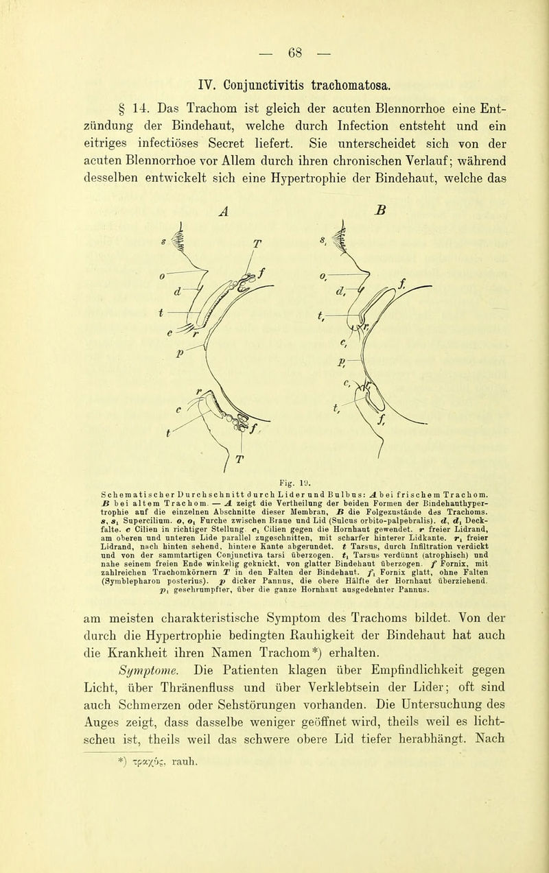 IV. Conjunctivitis traciomatosa. § 14. Das Trachom ist gleich der acuten Blennorrhoe eine Ent- ziindung der Bindehaut, welche durch Infection entsteht und ein eitriges infectioses Secret liefert. Sie imtersclieidet sich von der acuten Blennorrhoe vor Allem durch ihren chronischen Verlauf; wahrend desselben entwickelt sich eine Hypertrophie der Bindehaut, welche das A B Fig. ly. Scliemati3CherUurclisclinittdurcliLidernndBuIbn3:.4.beifrisoliemTracliom. S bei altem Trachom. — A. zeigt die Vertheilnng der beiden Formen der Bindehanthyper- tropbie auf die einzelnen Abschnitte dieser Membran, U die Folgezustande des Trachoms. «, «! Supercilinm. o, o^ Farche zwischen Brane nnd Lid (Sulcus orbito-palpebralis). d, Deck- falte. c Cilien in richtiger Stellung Ci Cilien gegen die Hornhaut gewendet. r freier Lidrand, am oberen und unteren Lide parallel zugescbnitten, mit scharfer hinterer Lidkante. Ti freier Lidrand, nncb hinten sehend, hinteie Kante abgernndet. t Tarsus, durch Infiltration verdickt und von der sammtartigen Conjunctiva tarsi iiberzogen. i, Tarsus verdiinnt (atrophiscb) nnd nahe seinem freien Ende winkelig goknickt, von glatter Bindehaut uberzogen. / Fornix, mit zahlreiciien Trachomkornern T in den Falten der Bindehaut. /, Fornix glatt, ohne Fallen (SymblepharoD posterius). p dicker Pannns, die obere Halfte der Hornhant iiberziehend. Pt gesohrumpfter, tiber die ganze Hornhaut ansgedehnter Pannus. am meisten charakteristische Symptom des Trachoms bildet. Von der durch die Hypertrophie bedingten Rauhigkeit der Bindehaut hat auch die Krankheit ihren Namen Trachom*) erhalten. Symptome. Die Patienten klagen iiber Empfindlichkeit gegen Licht, iiber Thranenfluss und iiber Verklebtsein der Lider; oft sind auch Schmerzen oder Sehstorungen vorhanden. Die Untersuchung des Auges zeigt, dass dasselbe weniger geoffnet wird, theils well es licht- scheu ist, theils weil das schwere obere Lid tiefer herabhangt. Nach *) -cpaj^ug, rauh.