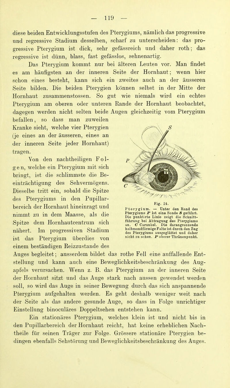 diese beiden Entwicklungsstufen des Pterygiums, namlich das progressive und regressive Stadium desselben, scharf zu unterscheiden: das pro- gressive Pterygium ist dick, sehr gefassreich und daher roth; das regressive ist diinn, blass, fast gefasslos, sehnenartig. Das Pterygium kommt nur bei alteren Leuten vor. Man findet es am haufigsten an der inneren Seite der Hornhaut; wenn hier schon eines besteht, kann sich ein zweites auch an der ausseren Seite bilden. Die beiden Pterygien konnen selbst in der Mitte der Hornhaut zusammenstossen. So gut wie niemals vrird ein echtes Pterygium am oberen oder unteren Rande der Hornhaut beobachtet, dagegen werden nicht selten beide Augen gleichzeitig vom Pterygium befallen, so dass man zuweilen Kranke sieht, welche vier Pterygien (je eines an der ausseren, eines an der inneren Seite jeder Hornhaut) tragen. Yon den nachtheiligen Fol- gen, welche ein Pterygium mit sich bringt, ist die schlimmste die Be- eintrachtigung des Sehvermogens. Dieselbe tritt ein, sobald die Spitze des Pterygiums in den Pupillar- bereich der Hornhaut hineinragt und nimmt zu in dem Maasse, als die Spitze dem Hornhautcentrum sich nahert. Im progressiven Stadium ist das Pterygium iiberdies von einem bestandigen Reizzustande des Auges begleitet; ausserdem bildet das rothe Fell eine auffallende Ent- stellung und kann auch eine Beweglichkeitsbeschriinkung des Aug- apfels verursachen. Wenn z. B. das Pterygium an der inneren Seite der Hornhaut sitzt und das Auge stark nach aussen gewendet w^erden soil, so wird das Auge in seiner Bewegung durch das sich anspannende Pterygium aufgehalten werden. Es geht deshalb weniger weit nach der Seite als das andere gesunde Auge, so dass in Folge unrichtiger Einstellung binoeulares Doppeltsehen entstehen kann. Ein stationiires Pterygium, welches klein ist und nicht bis in den Pupillarbereich der Hornhaut reicht, hat keine erheblichen Nach- theile flir seinen Trager zur Folge. Grossere stationare Pterygien be- dingen ebenfalls Sehstorung und Beweglichkeitsbeschrankung des Auges. Fig. 24. Pterygium. — 0nter den Rand dea Pterygiums jP ist eine Sonde S gefuhrt. Die punktirte Linie zeigt die Schnitt- fuhrnng bei Abtragnng des Pterygiums an. C Carunkel. Die darangrenzende halbmondformigeFalte ist durch den Zug des Pterygiums ansgeglattet und daher nicht zu sohen. I* oberer Thranenpnnkt.