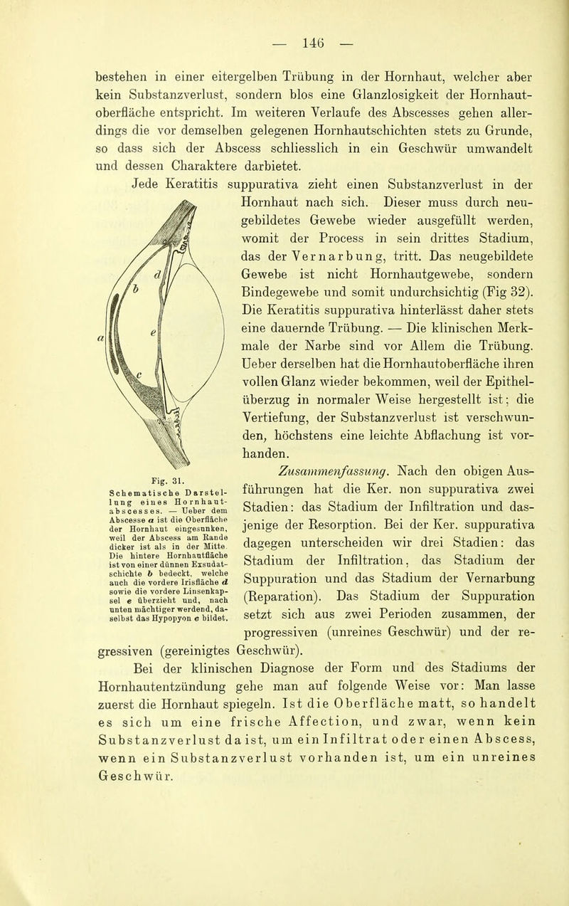 bestehen in einer eitergelben Triibung in der Hornhaut, welcher aber kein Substanzverlust, sondern bios eine Glanzlosigkeit der Hornhaut- oberflache entspricht. Im weiteren Verlaufe des Abscesses gehen aller- dings die vor demselben gelegenen Hornhautschichten stets zu Grande, so dass sich der Abscess schliesslich in ein Geschwiir umwandelt und dessen Charaktere darbietet. Jede Keratitis suppurativa zieht einen Substanzverlust in der Hornhaut naeh sich. Dieser muss durch neu- gebildetes Gewebe wieder ausgefiillt werden, womit der Process in sein drittes Stadium, das der Vernarbung, tritt. Das neugebildete Gevpebe ist nicht Hornhautgev^ebe, sondern Bindegewebe und somit undurchsichtig (Fig 32). Die Keratitis suppurativa hinterlasst daher stets eine dauernde Triibung. — Die klinischen Merk- male der Narbe sind vor Allem die Triibung. Ueber derselben hat die Hornhautoberflache ihren vollen Glanz wieder bekommen, weil der Epithel- iiberzug in normaler Weise hergestellt ist; die Vertiefung, der Substanzverlust ist verschvs^un- den, hochstens eine leichte Abflachung ist vor- handen. Zusammenfassung. Nach den obigen Aus- fiihrungen hat die Ker. non suppurativa zwei Stadien: das Stadium der Infiltration und das- jenige der Resorption. Bei der Ker. suppurativa dagegen unterscheiden vpir drei Stadien: das Stadium der Infiltration, das Stadium der Suppuration und das Stadium der Vernarbung (Reparation). Das Stadium der Suppuration setzt sich aus zwei Perioden zusammen, der progressiven (unreines Geschwiir) und der re- gressiven (gereinigtes Geschwiir). Bei der klinischen Diagnose der Form und des Stadiums der Hornhautentziindung gehe man auf folgende Weise vor: Man lasse zuerst die Hornhaut spiegeln. Ist die Oberflache matt, so handelt es sich um eine frische Affection, und zwar, wenn kein Substanzverlust da ist, um ein Infiltrat oder einen Abscess, wenn ein Substanzverlust vorhanden ist, um ein unreines Geschwiir. Fig. 31. Schematische Darstel- Inng eiues Hornhaut- abscesses. — Ueber dem Abscesse a ist die Oberflaclie der Hornhaut eingesnnlien, weil der Abscess am Rande dicker ist als in der Mitte Die hintere Hornhautflache ist von elner dflnnen Exsndat- schicble b bedeckt. welche anch die vordere Irisflacbe d. sowie die vordere Linsenkap- sel e uberzieht und, nach nnten niachtiger werdend, da- selbat das Hypopyon c bildet.