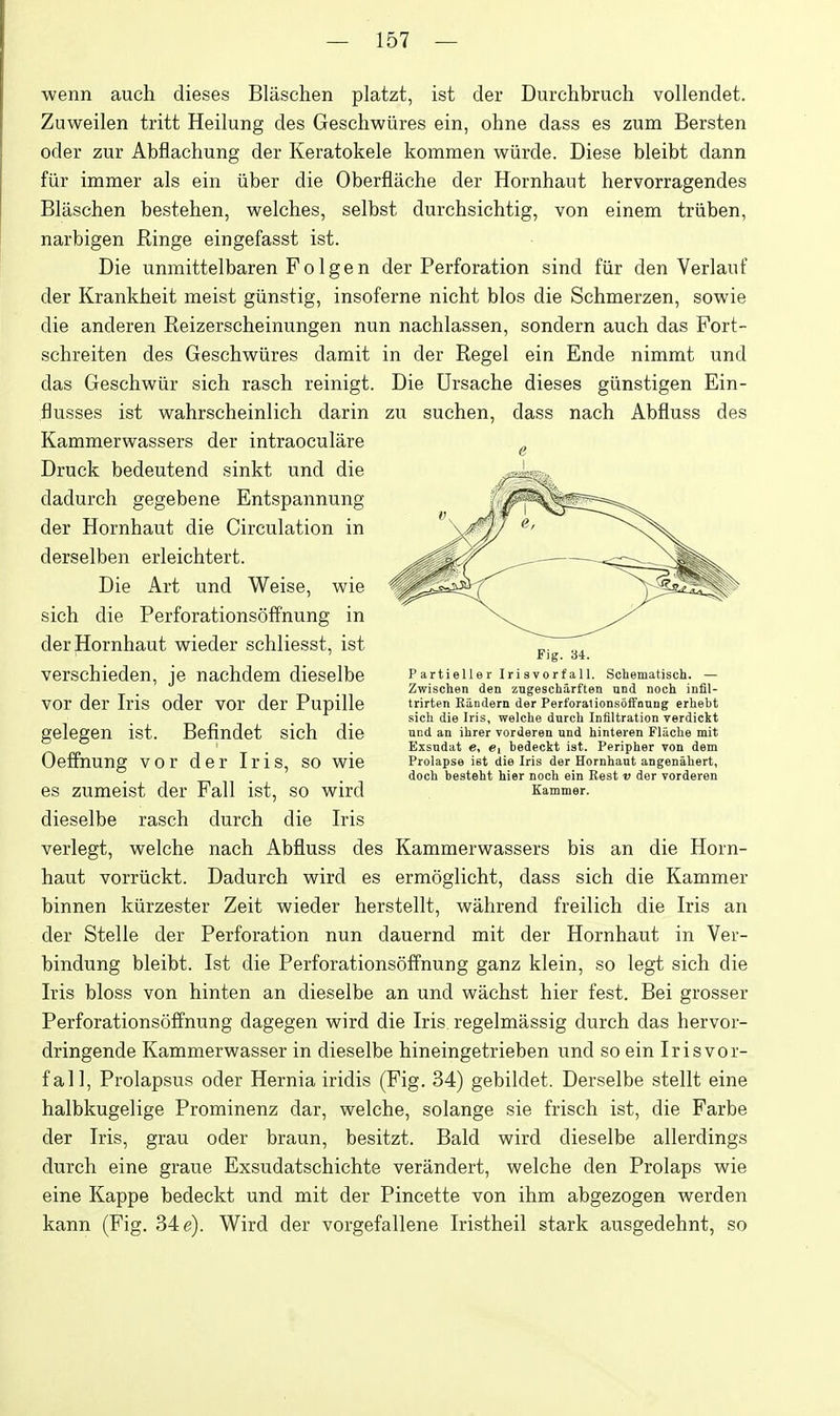 wenn auch dieses Blaschen platzt, ist der Durchbruch vollendet. Zuweilen tritt Heilung des Geschwiires ein, ohne dass es zum Bersten oder zur Abflachung der Keratokele koramen wiirde. Diese bleibt dann fiir immer als ein iiber die Oberflache der Hornhaut hervorragendes Blaschen bestehen, welches, selbst durchsichtig, von einem triiben, narbigen Ringe eingefasst ist. Die unmittelbaren F 01 g e n der Perforation sind fiir den Verlaiif der Krankheit meist giinstig, insoferne nicht bios die Schmerzen, sowie die anderen Reizerscheinungen nun nachlassen, sondern auch das Fort- schreiten des Geschwiires damit in der Regel ein Ende nimmt und das Geschwiir sich rasch reinigt. Die Ursache dieses giinstigen Ein- flusses ist wahrscheinlich darin zu suchen, dass nach Abfluss des Kammerwassers der intraoculare Druck bedeutend sinkt und die dadurch gegebene Entspannung der Hornhaut die Circulation in derselben erleichtert. Die Art und Weise, wie sich die Perforationsoffnung in der Hornhaut wieder schliesst, ist verschieden, je nachdem dieselbe vor der Iris oder vor der Pupille gelegen ist. Befindet sich die Oeffnung vor der Iris, so wie es zumeist der Fall ist, so wird dieselbe rasch durch die Iris verlegt, welehe nach Abfluss des Kammerwassers bis an die Horn- haut vorriickt. Dadurch wird es ermoglicht, dass sich die Kammer binnen kiirzester Zeit wieder herstellt, wahrend freilich die Iris an der Stelle der Perforation nun dauernd mit der Hornhaut in Ver- bindung bleibt. Ist die Perforations5ffnung ganz klein, so legt sich die Iris bloss von hinten an dieselbe an und wachst hier fest. Bei grosser Perforationsoffnung dagegen wird die Iris regelmassig durch das hervor- dringende Kammerwasser in dieselbe hineingetrieben und so ein Irisvor- fall, Prolapsus oder Hernia iridis (Fig. 34) gebildet. Derselbe stellt eine halbkugelige Prominenz dar, welche, solange sie frisch ist, die Farbe der Iris, grau oder braun, besitzt. Bald wird dieselbe allerdings durch eine graue Exsudatschichte verandert, welche den Prolaps wie eine Kappe bedeckt und mit der Pincette von ihm abgezogen werden kann (Fig. 34 e). Wird der vorgefallene Iristheil stark ausgedehnt, so Fig. 34. Partieller Irisvorfall. Schematisch. — Zwischen den zngescharf'ten und noch infil- trirten Eiindern der Perforationsoffnang erliebt sich die Iris, welche durch Infiltration verdickt und an ihrer vorderen und hinteren Flache mit Exsudat e, bedeckt ist. Peripher von dem Prolapse ist die Iris der Hornhaut angenahert, doch besteht hier noch ein Eeat i? der vorderen Kammer.