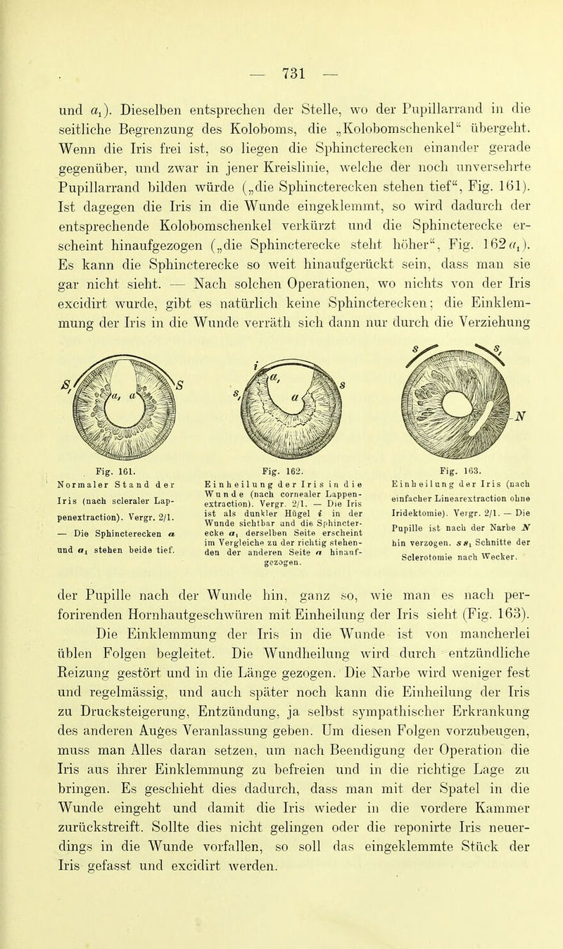 und Oi). Dieselben entsprechen der Stelle, wo der Pupillarrand in die seitliche Begrenzung des Koloboms, die „Kolobomschenker' iibergeht. Wenn die Iris frei ist, so liegen die Sphincterecken einaiader gevade gegeniiber, und zwar in jener Kreislinie, welche der nocli unverselirte Pupillarrand bilden wiirde („die Spliincterecken stehen tief, Fig. 161). Ist dagegen die Iris in die Wunde eingeklemmt, so wird dadurch der entsprechende Kolobomschenkel verkiirzt und die Sphincterecke er- scheint hinaufgezogen („die Sphincterecke steht holier, Fig. 162^1). Es kann die Sphincterecke so weit hinaufgerilckt sein, dass man sie gar nicht sieht. — Nach solchen Operationen, wo nichts von der Iris excidirt wurde, gibt es natiirlich keine Sphincterecken; die Einklem- mung der Iris in die Wunde verrath sich dann nur durch die Verziehung Fig. 161. Normaler Stand der Iris (nach scleraler Lap- penextraction). Vergr. 2/1. — Die Sphincterecken n nnd «! stehen beide tief. Fig. 162. Einheilung der Iris in die Wunde (nach cornealer Lappen- extraction). Vergr. 2/1. — Die Iris ist als dunkler Hugel i in der Wnnde sichtbar and die Spliincter- ecke CT, derselben Seite erscheint im Vergleiche zu der riclitig stehen- dea der anderen Seite n hiiiauf- gezogea. Fig. 163. Einheilung der Iris (nach einfacher Linearextraction ohne Iridelitomie). Vergr. 2/1. — Die Pupille ist nach der Narbe JV bin verzogen. s«i Schnitte der Sclerotomie nach Weclcer. der Pupille nach der Wunde hin, ganz so, wie man es nach per- forirenden Hornhautgeschwiiren mit Einheilung der Iris sieht (Fig. 163). Die Einklemmung der Iris in die Wunde ist von mancherlei ixblen Folgen begleitet. Die Wundheilung wird durch entziindliche Keizung gestort und in die Lange gezogen. Die Narbe wird weniger test und regelmassig, und audi spater noch kann die Einheilung der Iris zu Drucksteigerung, Entziindung, ja selbst sympathisclier Erkrankung des anderen Auges Veranlassung geben. Um diesen Folgen vorzubeugen, muss man Alles daran setzen, um nach Beendigung der Operation die Iris aus ihrer Einklemmung zu befreien und in die richtige Lage zu bringen. Es geschieht dies dadurch, dass man mit der Spatel in die Wunde eingeht und damit die Iris wieder in die vordere Kammer zuriickstreift. SoUte dies nicht gelingen oder die reponirte Iris neuer- dings in die Wunde vorfallen, so soil das eingeklemmte Stiick der Iris gefasst und excidirt werdeii.