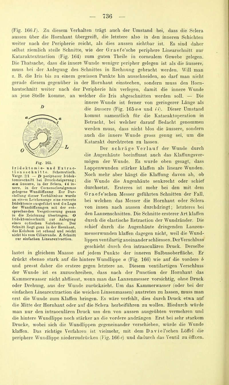 (Fig. 166 i). Zu diesem Verhalten tragt auch der Umstand bei, dass die Sclera aussen iiber die Hornliaut iibergreift, die letztere also in den inneren Schichten weiter nach der Peripherie reicht, als dies aussen sichtbar ist. Es sind daher selbst ziemlich steile Scbnitte, wie der Graefe'sche periphere Linearschnitt zur Kataraktextraction (Fig. 164) zum guten Theile in cornealem Gewebe gelegen. Die Thatsache, dass die innere Wunde weniger peripher gelegen ist als die aussere, muss bei der Anlegung des Sclinittes in Rechnung gebracht werden. Will man z. B. die Iris bis zu einem gewissen Punkte bin ausscbneiden, so darf man nicht gerade diesem gegenuber in der Hornhaut einstechen, sondern muss den Horn- hautschnitt weiter nach der Peripherie hin verlegen, damit die innere Wunde an jene Steile komme, an welcher die Iris abgeschnitten werden soil. — Die innere Wunde ist ferner von geringerer Lange als die aussere (Fig. 165 a« und ii). Dieser Umstand kommt namentlich fiir die Kataraktoperation in Betracht, bei welcher darauf Bedacht genommeu werden muss, dass nicht bios die aussere, sondern auch die innere Wunde gross genug sei, ura die Katarakt durchtreten zu lassen. Der schrage Verlauf der Wunde durch die Augenhaute beeinflusst auch das Klaffungsver- mogen der Wunde. Es wurde oben gesagt, dass Lappenwunden starker klaffen als lineare Wunden. Nocli mehr aber hangt die Klaffung davon ab, ob die Wunde die Augenhaute senkrecht oder schief durchsetzt. Ersteres ist mehr bei den mit dem Graefe'schen Messer gefiihrten Schnitten der Fall, bei wclchen das Messer die Hornhaut oder Sclera von innen nach aussen durchdringt; letzteres bei den Lanzenschnitten. Die Schnitte ersterer Art klaffen durch die elastische Retraction der Wundrander. Die schief durch die Augenhaute dringenden Lanzen- messerwunden klaffen dagegen nicht, weil die Wund- lippen ventilartig aneinander schliessen. DerVerschluss geschieht durch den intraocularen Druck. Derselbe lastet in gleichem Maasse auf jedem Punkte der inneren Bulbusoberflache. Er driickt ebenso stark auf die hintere Wundlippe a (Fig. 166) wie auf die vordere h und presst daher die erstere gegen letztere an. Diesem ventilartigen Verschluss der Wunde ist es zuzuschreiben, dass nach der Function der Hornhaut das Kammerwasser nicht abfliesst, wenn man das Lanzenmesser vorsichtig, ohne Druck oder Drehung, aus der Wunde zuriickzieht. Um das Kammerwasser (oder bei der einfachen Linearextraction die weichen Linsenmassen) austreten zu lassen, muss man erst die W'unde zum Klaffen bringen. Es ware verfehlt, dies durch Druck etwa auf die Mitte der Hornhaut oder auf die Sclera herbeifiihren zu wollen. Hiedurch wiirde man nur den intraocularen Druck um den von aussen ausgeiibten vcrmchren und die hintere Wundlippe noch starker an die vordere andrangen Erst bei sehr starkem Drucke, wobei sich die Wundlippen gegeneinander verschieben, wiirde die Wunde klaffen. Das richtige Verfahren ist vielmehr, mit dem Daviel'schen Loffel die periphere Wundlippe niederzudriitken (Fig. 166 c) und dadurch das Ventil zu offncn. D fig. 165. Iridektomie- nnd Extra c- tionsschnitte. Schematisch. Vergr. 2/1 — D periphei-er Iridek- tomiescbnift bei Dnicksteigernng; a a aussere, in der Sclera, ii in- nere, in der Corneoscleralgrenze gelegene Wnndoifnung. Znr Dar- stellung dieser Verhaltnisse warde an eiiieiTi Leiclienange eine corvecte Iridektomie ausgefulirt und dieLage der Wnndoffnungen mit der ent- sprechenden Vergrosserung genau in die Zeiclmuug iibertragen. O Iridektomieschnilt zur Aulegnng eines optischen Koloboms. Der Schnitt liegt ganz in der Hornliaut, das Kolobom ist schmal und reiclit nicht bis zum Ciliarrande. £ ScLnitt znr einfachen Linearextraction.