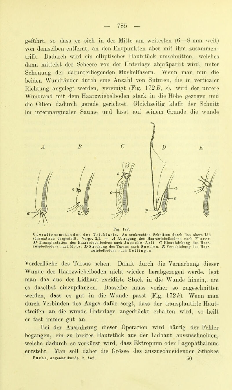 gefiihrt, so class er sich in der Mitte am weitesten (6—8 mm weit) von demselben entfernt, an den Endpunkten aber mit ilim zusammen- trifft. Dadurch wird ein elliptisches Hautstiick umsclinitten, welches dann mittelst der Scheere von der Unterlage abpraparirt wird, unter Schonung der darunterliegenden Muskelfasern. Wenn man nun die beiden Wundrander durch eine Anzahl von Suturen, die in verticaler Riclitung angelegt werden, vereinigt (Fig. 172 i?, s), wird der untere Wundrand mit dem Haarzwiebelboden stark in die Hohe gezogen und die Cilien dadurch gerade gerichtet. Gleichzeitig klafft der Schnitt im intermarginalen Saume und lasst auf seinem Grunde die wunde Fig. 172. 0perati0 nsm et h0den der Trichiasis. An sentrechten Schnitten dnrcli das obere Lid schemaliscb dargestellt. Vergr. 2/1. — A Abtragnng des Haarzwiebelbodens nacli Flarer. Transplantation des Haarzwiebelbodpns nach J a e s ch e - A rl t. C Hinaufziehnng des Haar- zwiebelbodens nachHotz. I> Streckung des Tarsus nach Snellen. £ Verschiebnng des Haar- zwiebelbodens nach Oettingen. Vorderflache des Tarsus sehen. Damit durch die Vernarbung dieser Wunde der Haarzwiebelboden nicht wieder herabgezogen werde, legt man das aus der Lidhaut excidirte Stiick in die Wunde hinein, um es daselbst einzupflanzen. Dasselbe muss vorher so zugeschnitten werden, dass es gut in die Wunde passt (Fig. 172 A). Wenn man durch Verbinden des Auges dafiir sorgt, dass der transplantirte Haut- streifen an die wunde Unterlage angedriickt erhalten wird, so heilt er fast immer gut an. Bei der Ausfiihrung dieser Operation wird haufig der Fehler begangen, ein zu breites Hautstiick aus der Lidhaut auszuschneiden, welche dadurch so verkiirzt wird, dass Ektropium oder Lagophthalmus entsteht. Man soli daher die Grosse des auszuschneidenden Stiickes Fncbs, Angenheilknnde. 2. Aufl. 50