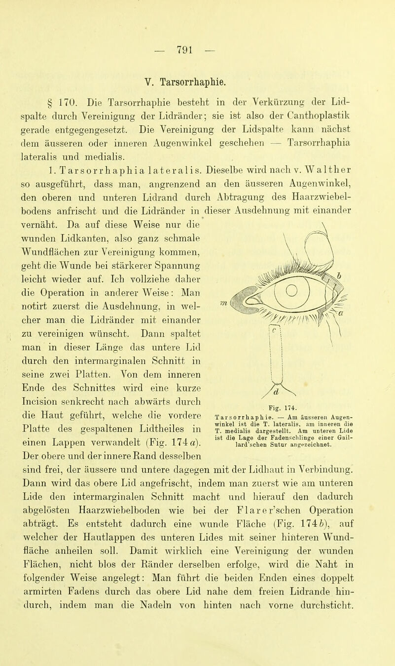 V. Tarsorrhaphie. § 170. Die Tarsorrhaphie besteht in cler Verkiirzung der Lid- spalte durch Vereinigung der Lidrander; sie ist also der Canthoplastik gerade entgegengesetzt. Die Vereinigung der Lidspalte kann nachst dem ausseren oder inneren Augenwinkel geschehen — Tarsorrhaphia lateralis und medialis. 1. Tarsorrhaphia lateralis. Dieselbe wird nach v. Walther so ausgefiihrt, dass man, angrenzend an den ausseren Augenwinkel, den oberen und unteren Lidrand durch Abtragung des Haarzwiebel- bodens anfrischt und die Lidrander in dieser Ausdehnung mit einander vernaht. Da auf diese Weise nur die wunden Lidkanten, also ganz schmale Wundflachen zur Vereinigung kommen, geht die Wunde bei starkerer Spannung leicht wieder auf. Ich vollziehe daher die Operation in anderer Weise: Man notirt zuerst die Ausdehnung, in wel- cher man die Lidrander mit einander zu vereinigen wiinscht. Dann spaltet man in dieser Lange das untere Lid durch den intermarginalen Schnitt in seine zwei Flatten. Von dem inneren Ende des Schnittes wird eine kurze Incision senkrecht nach abwarts durch die Haut gefiihrt, welche die vordere Platte des gespaltenen Lidtheiles in einen Lappen verwandelt (Fig. 174 a). Der obere und der innere Rand desselben sind frei, der aussere und untere dagegen mit der Lidhaut in Verbindung. Dann wird das obere Lid angefrischt, indem man zuerst wie am unteren Lide den intermarginalen Schnitt macht und hierauf den dadurch abgelosten Haarzwiebelboden wie bei der Flarer'schen Operation abtragt. Es entsteht dadurch eine wunde Fliiche (Fig. 174i), auf welcher der Hautlappen des unteren Lides mit seiner hihteren Wund- flache anheilen soli. Damit wirklich eine Vereinigung der wunden Flachen, nicht bios der Rander derselben erfolge, wird die Naht in folgender Weise angelegt: Man fiihrt die beiden Enden eines doppelt armirten Fadens durch das obere Lid nahe dem freien Lidrande hin- durch, indem man die Nadeln von hinten nach vorne durchsticht. Fig. 174. Tarsorrhaphie. — Am ausseren Augen- winkel ist die T. lateralis, am inneren die T. medialis dargestellt. Am unteren Lide ist die Lage der Fadensclilinge einer Gail- lard'schen Sutur angpzeichnet.