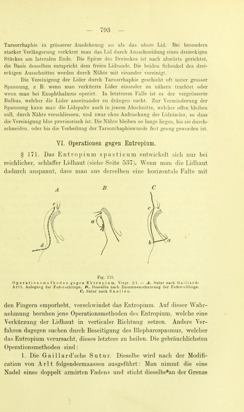 Tarsorrhaphie in grosseier Ausdehnung an als das obere Lid. Bei besonders starker Verlangerung verkiii-zt man das Lid durch Ausschneidung eines dreieckigen Stiickes am lateralen Ende. Die Spitze des Dreieckes ist nach abwiirts gerichtet, die Basis desselben entspricht dem freien Lidraiidc. Die beideii Schenkel des drei- eckigen Ausschnittes werden durch Nahte mit oinandor vereinigt. Die Vereinigung der Lider durch Tarsorrhaphie geschieht oft unter grosser Spannung, z B. wenn man verkiirzte Lider einander zu nahern trachtet oder wenn man bei Exophthalmus operirt. In letzterem Falle ist es der vergrosserte Bulbus, welcher die Lider auseinander zu drangen sucfat. Zur Verminderung der Spannung kann man die Lidspalte auch in jenem Abschnitte, welcher offen bleiben soil, durch Nahte verschliessen, und zwar ohne Anfrischung der Lidrander, so dass die Vereinigung bios provisorisch ist. Die Nahte bleiben so lange liegen, bis sie durch- schneiden. oder bis die Verheilung der Tarsorrhaphiewunde fest genug geworden ist. VI. Operationen gegen Entropium. § 171. Das Entr opium spasticum entwickelt sich nur bei reicMicher, schlaffer Lidhaut (sielie Seite 537). Wenn man die Lidhaut dadurch anspannt, dass man aus derselben eine horizontale Falte mit Fig. 175. Operations niHt'hoden gegen Eitropiam. Yfrgr. 2/1. — A.. Satur naeh G a i 11 a r d- Arlt. Anlegnng der Fadi-r.schlinge. H, Uasselbe nach Za.'^amincnscbnurasg der Faden^chlinge. C. Satur nacU Snellen. den Fingern emporhebt, verschwindet das Entropium. Auf dieser Wahr- nelimung beruhen jene Operationsmethoden des Entropium, welche eine Verkiirzung der Lidhaut in verticaler Riciitung setzen. Andere Ver- fahren dagegen suchen durch Beseitigung des Blepharospasmus, welcher das Entropium verursacht, dieses letztere zu lieilen. Die gebrauchlichsten Operationsmethoden sind: 1. Die Gaillard'sche Sutur. Dieselbe wird nach der Modifi- cation von Arlt folgendermaassen ausgefiihrt: Man nimmt die eine Nadel eines doppelt armirten Fadens und sticht dieselbe'an der Grenze