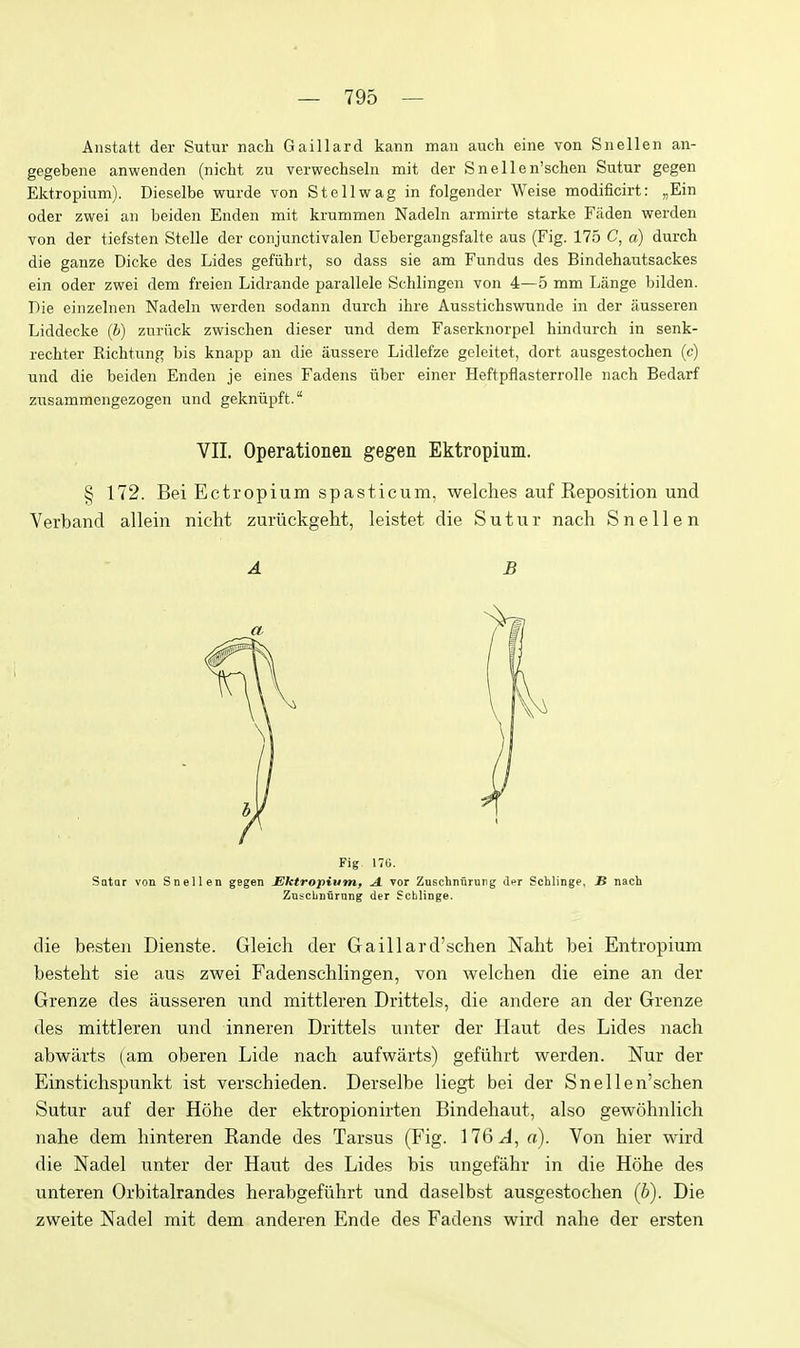 Anstatt der Sutur nach Gaillard kann man auch eine von Snellen an- gegebene anwenden (nicht zu verwechsein mit der S n e 11 e n'schen Sutur gegen Ektropium). Dieselbe wurde von Stellvsrag in folgender Weise modificirt: ,,Ein Oder zwei an beiden Enden mit krummen Nadeln armirte starke Faden vsrerden von der tiefsten Stelle der conjunctivalen Debergangsfalte aus (Fig. 175 C, a) durch die ganze Dicke des Lides gefiihrt, so dass sie am Fundus des Bindehautsackes ein Oder zwei dem freien Lidrande parallele Schlingen von 4—5 mm Lange bilden. Pie einzelnen Nadeln werden sodann durch ihre Aussticbswunde in der ausseren Liddecke {b) zuriick zwischen dieser und dem Faserknorpel hindurch in senk- rechter Richtnng bis knapp an die aussere Lidlefze gcleitet, dort ausgestochen (c) und die beiden Enden je eines Fadens iiber einer Heftpflasterrolle nach Bedarf zusammengezogen und gekniipft. VII. Operationen gegen Ektropium. § 172. Bei Ectropium spasticum, welches auf Reposition und Verband allein nicht zuriickgeht, leistet die Sutur nach Snellen A B Fig 170. Sotar von Snellen gegen Ektropium, A. vor Zuschnflrurg ifi Schlinge, B nach Zuscbnurnng der Scblinge. die besten Dienste. Gleich der Gaillard'schen Naht bei Entropium besteht sie aus zwei Fadenschlingen, von welchen die eine an der Grenze des ausseren und mittleren Drittels, die andere an der Grenze des mittleren und inneren Drittels unter der Haut des Lides nach abwarts (am oberen Lide nach aufwarts) gefiihrt werden. Nur der Einstichspunkt ist verschieden. Derselbe liegt bei der Snellen'schen Sutur auf der Hohe der ektropionirten Bindehaut, also gewohnlich nahe dem hinteren Rande des Tarsus (Fig. 176 J, a). Von hier wird die Nadel unter der Haut des Lides bis ungefahr in die Hohe des unteren Orbitalrandes herabgefixhrt und daselbst ausgestochen (b). Die zweite Nadel mit dem anderen Ende des Fadens wird nahe der ersten