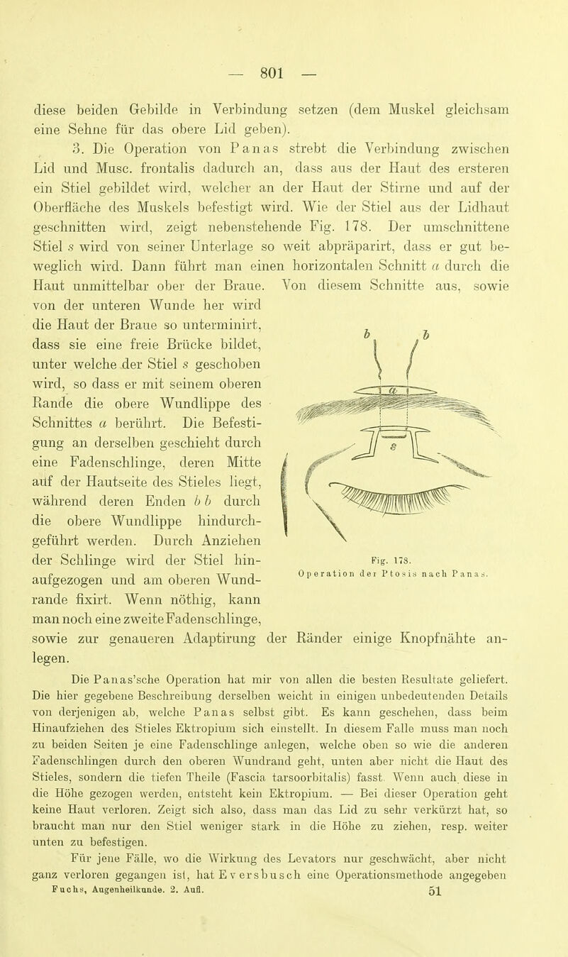 diese beiden Gebilde in Verbindung setzen (dem Muskel gleichsam eine Sehne fiir das obere Lid geben). 3. Die Operation von Pan as strebt die Verbindung zwischen Lid und Muse, frontalis dadurch an, dass aus der Haut des ersteren ein Stiel gebildet wird, welcher an der Haut der Stirne und auf der Oberflache des Muskels befestigt wird. Wie der Stiel aus der Lidhaut geschnitten wird, zeigt nebenstehende Fig. 178. Der umscbnittene Stiel .s wird von seiner Unterlage so weit abpraparirt, dass er gut be- weglich wird. Dann fuhrt man einen horizontalen Scbnitt (t durch die Haut unmittelbar ober der Braue. Von diesem Schnitte aus, sowie von der unteren Wunde her wird die Haut der Braue so unterminirt, rande fixirt. Wenn noting, kann man noch eine zweiteFadenschlinge, sowie zur genaueren Adaptirung der Bander einige Knopfnahte an- legen. Die Panas'sche Operation hat mir von alien die besten Resultate geliefert. Die hier gegebene Beschreibung derselben weicht in einigeu unbedeutendeii Details von derjenigen ab, welche Pan as selbst gibt. Es kann geschehen, dass beim Hinaufziehen des Stieles Ektropimn sich einstellt. In diesem Falle muss man noch zu beiden Seiten je eine Fadenschlinge anlegen, welche oben so wie die anderen Fadenschlingen durch den oberen Wundraud geht, unten aber nicht die Haut des Stieles, sondern die tiefen Theile (Fascia tarsoorbitalis) fasst. Wenn auch diese in die Hohe gezogen werden, entsteht kein Ektropium. — Bei dieser Operation geht keine Haut verloren. Zeigt sich also, dass man das Lid zu sehr verkiirzt hat, so braucht man nur den Stiel weniger stark in die Hohe zu ziehen, resp. weiter unten zu befestigen. Fiir jene Falle, wo die Wirknug des Levators nur geschwacht, aber nicht ganz verloren gegangeu ist, hat E v ersbusch eine Operationsmethode angegeben Fuchs, Aagenheilkaade. 2, AnS. 51 dass sie eine freie Briicke bildet, unter welche der Stiel s geschoben wird, so dass er mit seinem oberen Rande die obere Wundlippe des Schnittes a beriihrt. Die Befesti- gung an derselben geschieht durch eine Fadenschlinge, deren Mitte aiif der Hautseite des Stieles liegt, wahrend deren Enden b h durch die obere Wundlippe hindurch- gefiihrt werden. Durch Anziehen der Schlinge wird der Stiel hin- aufgezogen und am oberen Wund- Fig. ns. Operation der I'tosis nach Panas.