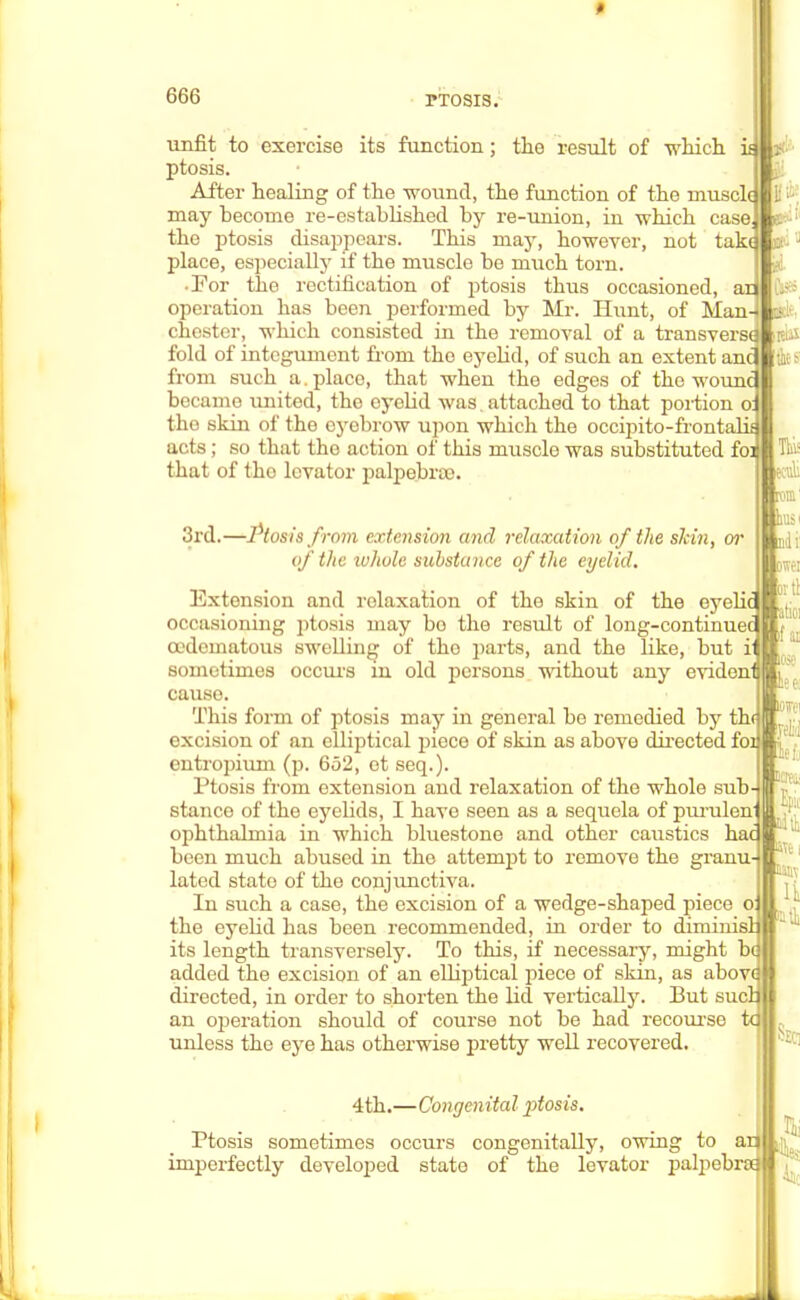 ♦ 666 ptosis. unfit to exercise its function; the result of which ptosis. After healing of the wound, the function of the muscle may become re-established by re-union, in which case, the ptosis disappears. This may, however, not take place, especially if the muscle be much torn. • For the rectification of ptosis thus occasioned, ai operation has been performed by Mr. Hunt, of Man- chester, which consisted in the removal of a transversa fold of integument from the eyelid, of such an extent anc from such a. place, that when the edges of the wounc became united, the eyelid was. attached to that portion o: the skin of the eyebrow upon which the occipito-frontabi acts; so that the action of this muscle was substituted fo: that of tho levator palpebral. 3rd.—Ptosis from extension and relaxation of the skin, or of the whole substance of the eyelid. Extension and relaxation of the skin of the eyeUc occasioning ptosis may bo the result of long-continuec oedematous swelling of tho parts, and the like, but ii sometimes occurs in old persons without any evident cause. This form of ptosis may in general be remedied by th< excision of an elliptical piece of skin as above directed foi entropium (p. 652, ot seq.). Ptosis from extension and relaxation of the whole sub stance of the eyelids, I have seen as a sequela of purulen' ophthalmia in which bluestone and other caustics been much abused in the attempt to remove the granu- lated state of the conjunctiva. In such a case, the excision of a wedge-shaped piece the eyelid has been recommended, in order to diminis] its length transversely. To this, if necessary, might be added the excision of an elliptical piece of skin, as above directed, in order to shorten the lid vertically. But sue! an operation should of course not be had recourse tc unless the eye has otherwise pretty well recovered. 4th.—Congenital jitosis. Ptosis sometimes occurs congenitally, owing to an imperfectly developed state of the levator palpebraa Seci