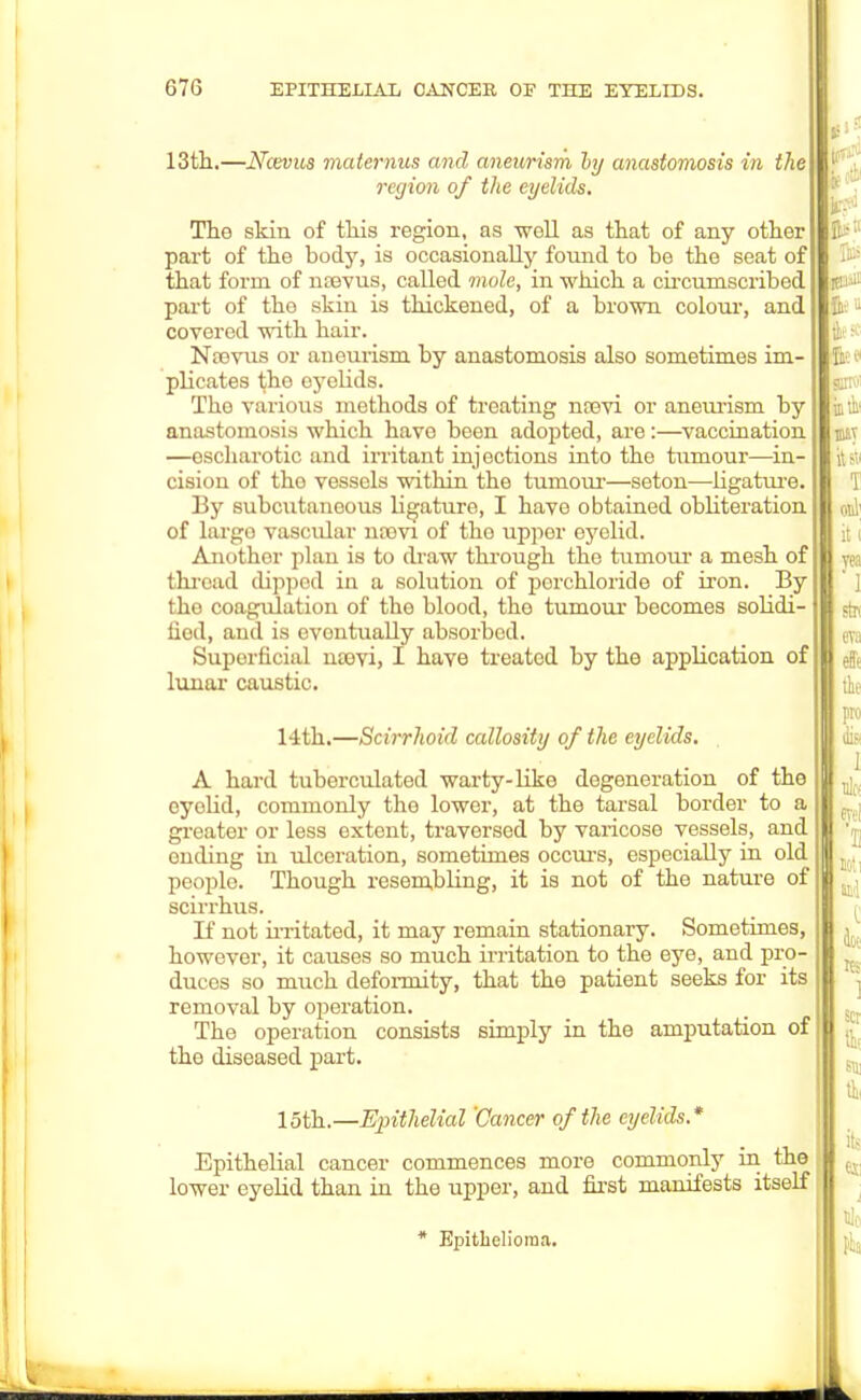 13th.—Ncevus maternus and aneurism ly anastomosis in the region of the eyelids. The skin of this region, as woll as that of any other part of the body, is occasionally found to be the seat of that form of nEevus, called mole, in which a circumscribod part of the skin is thickened, of a brown colour, and covered with hair. Ntevus or aneurism by anastomosis also sometimes im- plicates the oyelids. Tho various methods of treating noevi or aneurism by anastomosis which have been adopted, are:—vaccination —oscharotic and irritant injections into the tumour—in- cision of tho vessels within the tumour—seton—ligature. By subcutaneous ligature, I have obtained obliteration of largo vascular ncovi of tho upper eyelid. Anothor plan is to draw through tho tumour a mesh of thread dipped in a solution of porchloride of iron. By the coagulation of the blood, the tumour becomes solidi- liod, and is ovontually absorbed. Superficial nsevi, I have treated by the application of lunar caustic. 14th.—Scirrhoid callosity of the eyelids. . A hard tuberculated warty-Like degeneration of the eyelid, commonly the lower, at the tarsal border to a greater or less extont, traversed by varicose vessels, and onding in ulceration, sometimes occurs, especially in old people. Though resembling, it is not of the nature of scirrhus. If not irritated, it may remain stationary. Sometimes, however, it causes so much irritation to the eye, and pro- duces so much deformity, that the patient seeks for its removal by operation. The operation consists simply in the amputation of tho diseased part. 15th.—Epithelial 'Cancer of the eyelids.* Epithelial cancer commences more commonly in the lower eyelid than in the upper, and first manifests itself * Epithelioma.