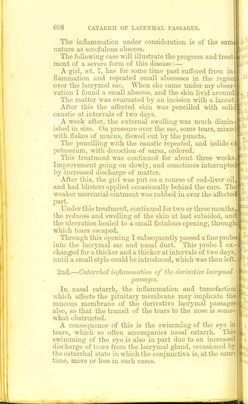 fee 1 0'~v 698 CATARRH OF LACRYMAL PASSAGES. The inflammation under consideration is of the samj nature as scrofulous abscess. The following case will illustrate the progress and treat ment of a severe form of this disease:— A girl, pet. 7, has for some time past suffered from in' flammation and repeated small abscesses in the regioi over the lacrymal sac. When she came under my obser vation I found a small abscess, and the skin livid around The matter w as evacuated by an incision with a lancet After this the affectod skin was pencilled with solic caustic at intervals of two days. A week after, the oxtornal swelling was much dimin- ished in size. On pressure over the sac, some tears, mixec with flakes of mucus, ilowed out by the puncta. Tho pencilling with tho caustic repeated, and iodide o: potassium, with decoction of sarsa, ordered. This treatment was continued for about three weeks. Improvement going on slowly, and sometimes interrupted I by incroased discharge of matter. After this, tho girl was put on a course of cod-bver oil and had blisters applied occasionally behind the ears. Th( weaker mercurial ointmont was rubbed in over the affectedj part. Under this treatment, continued for two or throe months tho redness and swelling of the skin at last subsided, and tho ulceration healed to a small fistulous opening, through which tears escaped. Through this opening I subsequently jiassed a fine probe> into the laciyinal sac and nasal duct. This probe I ex- *rii changed for a thicker and a thicker at intervals of two days, until a small stylo could be introduced, which was then left. 2nd.—Catarrhal inflammation of the derivative lacrymal passaycs. In nasal catarrh, the inflammation and tumefaction which affects the pituitary membrane may impUcate the mucous membrane of the derivative lacrymal passages also, so that the transit of the tears to the nose is some what obstructed. A consequence of this is the swimming of the eye in tears, which so often accompanies nasal catarrh. This swimming of the eye is also in part due to an increased dischargo of tears from tho lacrymal gland, occasioned by the catarrhal state in which the conjunctiva is, at the same time, more or less in such cases. L '•tie Let ►in tn Jft \ St