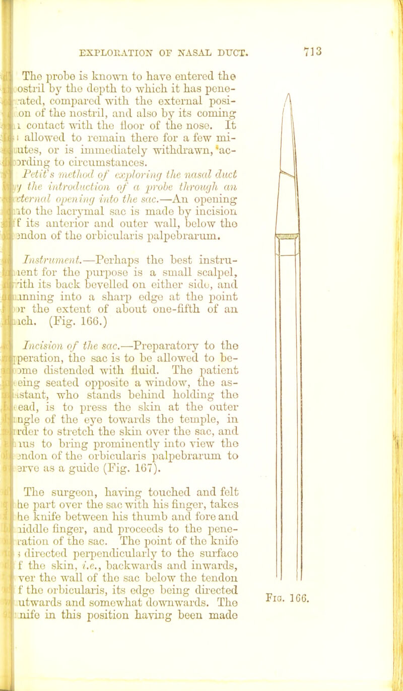 The probe is known to have entered the ostril by the depth to which it has pcne- •ated, compared with the external posi- .on of the nostril, and also by its coming i contact with the floor of the nose. It : allowed to remain there for a few rni- uteSj or is immediately withdrawn, ao- Drding to circumstances. Petit'x method of exploring the nasal duct y the introduction of a probe through an eternal opening into the sac.—An opening ito the lacrymal sac is made by incision f its anterior and outer wall, below the mdon of the orbicularis palpebrarum. Instrument.—Perhaps the best instru- lent for the purpose is a small scalpel, ith its back bevelled on either side, and .inning into a sharp edge at the point >r the extent of about one-fifth of an ich. (Fig. 166.) Incision of the sac-—-Preparatory to the peration, the sac is to be allowed to be- )me distended with fluid. The patient eing seated opposite a window, the as- istant, who stands behind holding the ead, is to press tho skin at the outer ngle of the eye towards the temple, in rder to stretch the skin over the sac, and ins to bring prominently into view the jndon of the orbicularis palpebrarum to srve as a guide (Fig. 167). The surgeon, having touched and felt be part over the sac with his finger, takes be knife between his thumb and fore and riddle finger, and proceeds to the pene- ration of tho sac. The point of the knife j directed perpendicularly to the surface f the skin, i.e., backwards and inwards, ver the wall of tho sac below the tendon f the orbicularis, its edge being directed utwards and somewhat downwards. The nifo in this position huving been made