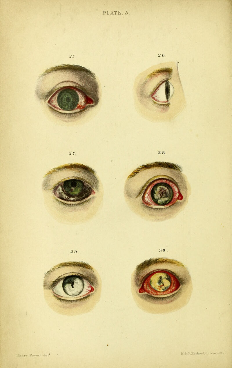 - nry Pcwwr, da]\ M: ^ ^ .HanVa-rl.Clveomo