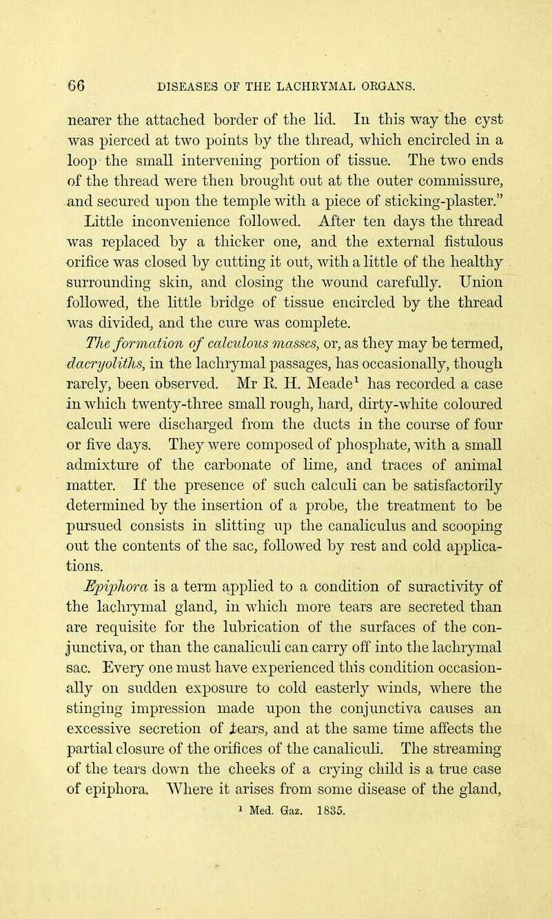 nearer the attached border of the lid. In this way the cyst was pierced at two points by the thread, which encircled in a loop the small intervening portion of tissue. The two ends of the thread were then brought out at the outer commissure, and secured upon the temple with a piece of sticking-plaster. Little inconvenience followed. After ten days the thread was replaced by a thicker one, and the external fistulous orifice was closed by cutting it out, with a little of the healthy surrounding skin, and closing the wound carefully. Union followed, the little bridge of tissue encircled by the thread was divided, and the cure was complete. The formation of calculous masses, or, as they may be termed, dacryolitlis, in the lachrymal passages, has occasionally, though rarely, been observed. Mr E. H. Meade ^ has recorded a case in which twenty-three small rough, hard, dirty-white coloured calculi were discharged from the ducts in the course of four or five days. They were composed of phosphate, with a small admixture of the carbonate of lime, and traces of animal matter. If the presence of such calculi can be satisfactorily determined by the insertion of a probe, the treatment to be pursued consists in slitting up the canahculus and scooping out the contents of the sac, followed by rest and cold applica- tions. Epiphora is a term applied to a condition of suractivity of the lachrymal gland, in which more tears are secreted than are requisite for the lubrication of the surfaces of the con- junctiva, or than the canaliculi can carry off' into the lachrymal sac. Every one must have experienced this condition occasion- ally on sudden exposure to cold easterly winds, where the stinging impression made upon the conjunctiva causes an excessive secretion of jbears, and at the same time affects the partial closure of the orifices of the canaliculi. The streaming of the tears down the cheeks of a crying child is a true case of epiphora. Where it arises from some disease of the gland, 1 Med. Gaz. 1835.