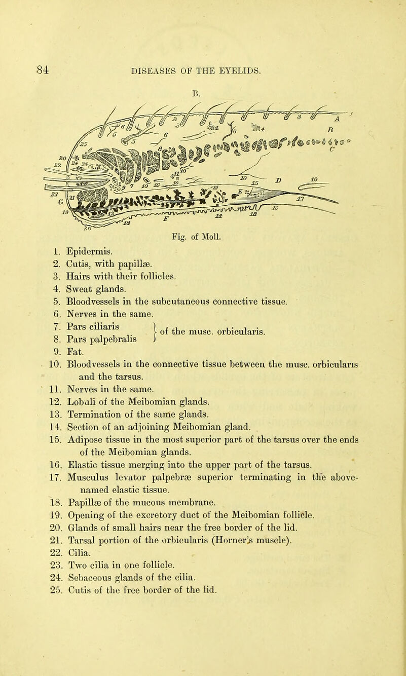 B. Fig. of Moll. 1. Epidermis. 2. Cutis, with papillae. 3. Hairs with their follicles. 4. Sweat glands. 5. Bloodvessels in the subcutaneous connective tissue. 6. Nerves in the same. 8. Pars palpebralis i 9. Fat. 10. Bloodvessels in the connective tissue between the muse, orbicularis and the tarsus. 11. Nerves in the same. 12. Lobdli of the Meibomian glands. 13. Termination of the same glands. 14. Section of an adjoining Meibomian gland. 15. Adipose tissue in the most superior part of the tarsus over the ends of the Meibomian glands. 16. Elastic tissue merging into the upper part of the tarsus. 17. Musculus levator palpebrse superior terminating in the above- named elastic tissue. 18. Papillae of the mucous membrane. 19. Opening of the excretory duct of the Meibomian follicle. 20. Glands of small hairs near the free border of the lid. 21. Tarsal portion of the orbicularis (Hornerls muscle). 22. Cilia. 23. Two cilia in one follicle. 24. Sebaceous glands of the ciha. 25. Cutis of the free border of the lid. 7. Pars ciliaris