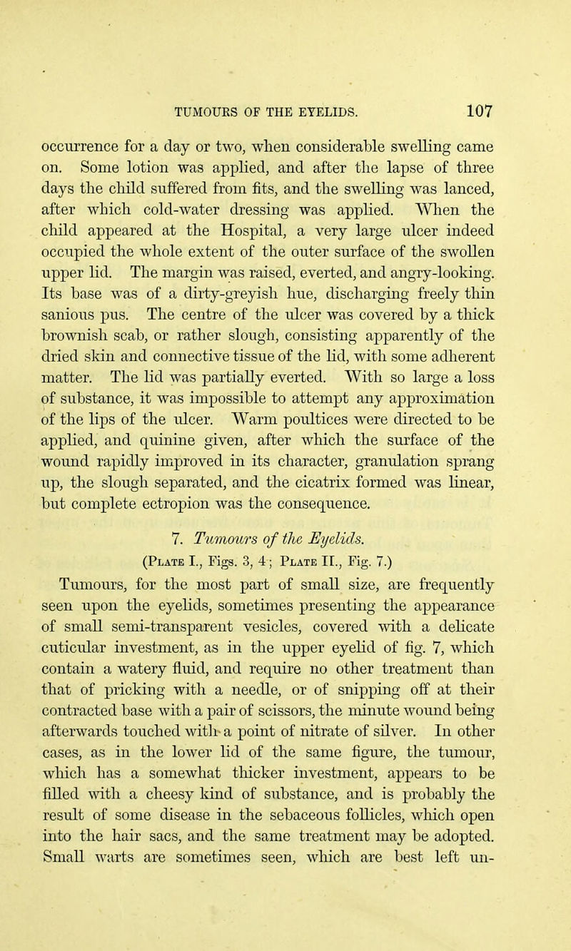 occurrence for a day or two, when considerable swelling came on. Some lotion was appKed, and after tlie lapse of three days the child suffered from fits, and the swelling was lanced, after which cold-water dressing was applied. When the child appeared at the Hospital, a very large ulcer indeed occupied the whole extent of the outer surface of the swollen upper lid. The margin was raised, everted, and angry-looking. Its base was of a dirty-greyish hue, discharging freely thin sanious pus. The centre of the ulcer was covered by a thick brownish scab, or rather slough, consisting apparently of the dried skin and connective tissue of the lid, with some adherent matter. The lid was partially everted. With so large a loss of substance, it was impossible to attempt any approximation of the lips of the ulcer. Warm poultices were directed to be applied, and quinine given, after which the surface of the wound rapidly improved in its character, granulation sprang up, the slough separated, and the cicatrix formed was linear, but complete ectropion was the consequence. 7. Tumours of the Eyelids. (Plate I., Figs. 3, 4; Plate 11., Fig. 7.) Tumours, for the most part of small size, are frequently seen upon the eyelids, sometimes presenting the appearance of small semi-transparent vesicles, covered with a delicate cuticular investment, as in the upper eyelid of fig. 7, which contain a watery fluid, and require no other treatment than that of pricking with a needle, or of snipping off at their contracted base with a pair of scissors, the minute wound being afterwards touched witli- a point of nitrate of sUver. In other cases, as in the lower lid of the same figure, the tumour, which has a somewhat thicker investment, appears to be filled with a cheesy kind of substance, and is probably the result of some disease in the sebaceous foUicles, which open into the hair sacs, and the same treatment may be adopted. Small warts are sometimes seen, which are best left un-