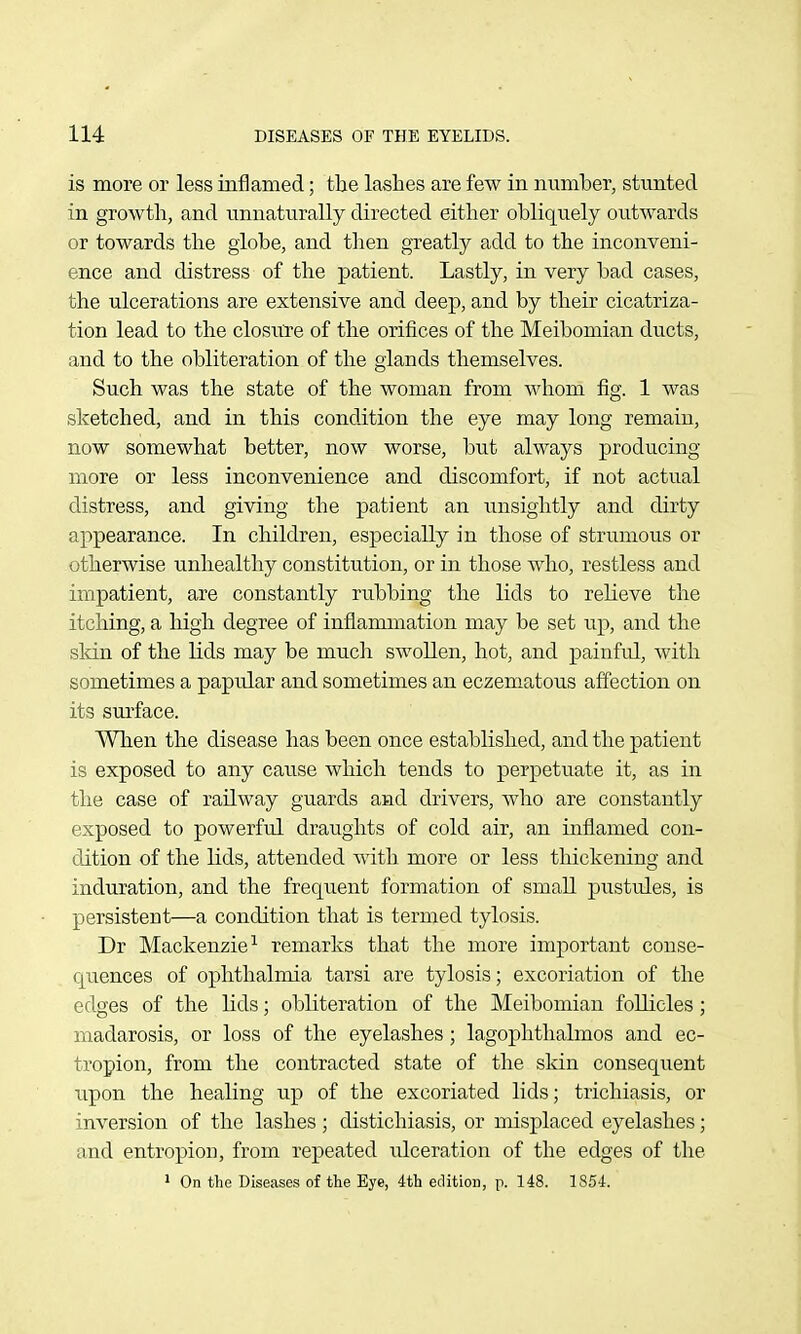 is more or less inflamed; the lashes are few in numher, stunted in growth, and unnaturally directed either obliquely outwards or towards the globe, and then greatly add to the inconveni- ence and distress of the patient. Lastly, in very bad cases, the ulcerations are extensive and deep, and by their cicatriza- tion lead to the closure of the orifices of the Meibomian ducts, and to the obliteration of the glands themselves. Such was the state of the woman from whom fig. 1 was sketched, and in this condition the eye may long remain, now somewhat better, now worse, but always producing more or less inconvenience and discomfort, if not actual distress, and giving the patient an imsightly and dirty appearance. In children, especially in those of strumous or otherwise unhealthy constitution, or in those who, restless and impatient, are constantly rubbing the lids to relieve the itching, a high degree of inflammation may be set up, and the skin of the lids may be much swollen, hot, and painful, with sometimes a papular and sometimes an eczematous affection on its sm-face. When the disease has been once established, and the patient is exposed to any cause which tends to perpetuate it, as in the case of railway guards and drivers, who are constantly exposed to powerful draughts of cold air, an inflamed con- dition of the lids, attended with more or less thickening and induration, and the frequent formation of small pustules, is persistent—a condition that is termed tylosis. Dr Mackenzie^ remarks that the more important conse- quences of ophthalmia tarsi are tylosis; excoriation of the edges of the lids; obliteration of the Meibomian follicles; madarosis, or loss of the eyelashes; lagophthalmos and ec- tropion, from the contracted state of the sldn consequent upon the healing up of the excoriated lids; trichiasis, or inversion of the lashes; distichiasis, or misplaced eyelashes; and entropion, from repeated ulceration of the edges of the ' On the Diseases of the Eye, 4th edition, p. 148. 1854.