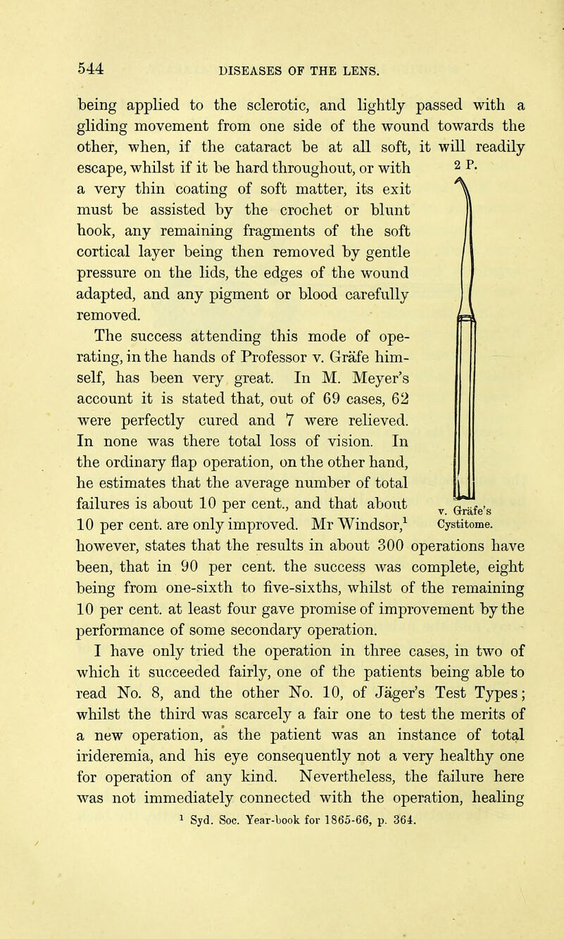 being applied to the sclerotic, and lightly passed with a gliding movement from one side of the wound towards the other, when, if the cataract be at all soft, it will readily escape, whilst if it be hard throughout, or with 2 P. a very thin coating of soft matter, its exit must be assisted by the crochet or blunt hook, any remaining fragments of the soft cortical layer being then removed by gentle pressure on the lids, the edges of the wound adapted, and any pigment or blood carefully removed. The success attending this mode of ope- rating, in the hands of Professor v. Grafe him- self, has been very great. In M. Meyer's account it is stated that, out of 69 cases, 62 were perfectly cured and 7 were relieved. In none was there total loss of vision. In the ordinary flap operation, on the other hand, he estimates that the average number of total failures is about 10 per cent., and that aboiit 10 per cent, are only improved. Mr Windsor,^ however, states that the results in about 300 operations have been, that in 90 per cent, the success was complete, eight being from one-sixth to five-sixths, whilst of the remaining 10 per cent, at least four gave promise of improvement by the performance of some secondary operation. I have only tried the operation in three cases, in two of which it succeeded fairly, one of the patients being able to read No. 8, and the other No. 10, of Jager's Test Types; whilst the third was scarcely a fair one to test the merits of a new operation, as the patient was an instance of total irideremia, and his eye consequently not a very healthy one for operation of any kind. Nevertheless, the failure here was not immediately connected with the operation, healing 1 Syd. Soc. Year-book for 1865-66, p. 364. V. Grafe's Cystitome.