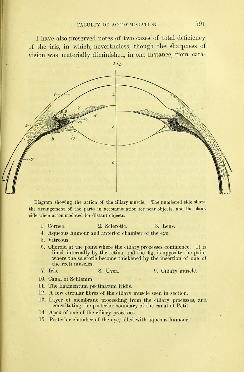 I have also preserved notes of two cases of total deficiency of the iris, in which, nevertheless, though the sharpness of vision was materially diminished, in one instance, from cata- 2 Q. Diagram showing the action of the ciliary muscle. The numbered side shows the arrangement of the parts in accommodation for near objects, and the blank side when accommodated for distant objects. 1. Cornea. 2. Sclerotic. 3. Lens. 4. Aqueous humour .and anterior chamber of the eye. 5. Vitreous. 6. Choroid at the point where the ciliary processes conlnlence. It is lined internally by the retina, and the fig. is opposite the point where the sclerotic become thickened by the insertion of one of the recti muscles. 7. Iris. 8. Uvea. 9. Ciliary musclei. 10. Canal of Schlemm. 11. The ligamentum pectinatum iridis. 12. A few circular fibres of the ciliary muscle seen in section. 13. Layer of membrane proceeding from the ciliary processes, and constituting the posterior boundary of the canal of Petit. 14. Apex of one of the ciliary processes. 15. Posterior chamber of the eye, tilled with aqueous humour.