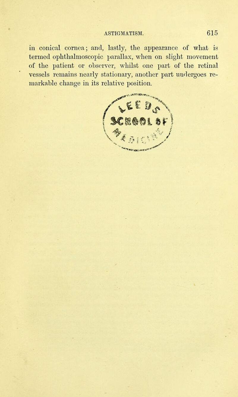 in conical cornea; and, lastly, the appearance of what is termed ophthalmoscopic parallax, when on slight movement of the patient or observer, whilst one part of the retinal vessels remains nearly stationary, another part undergoes re- markable change in its relative position.