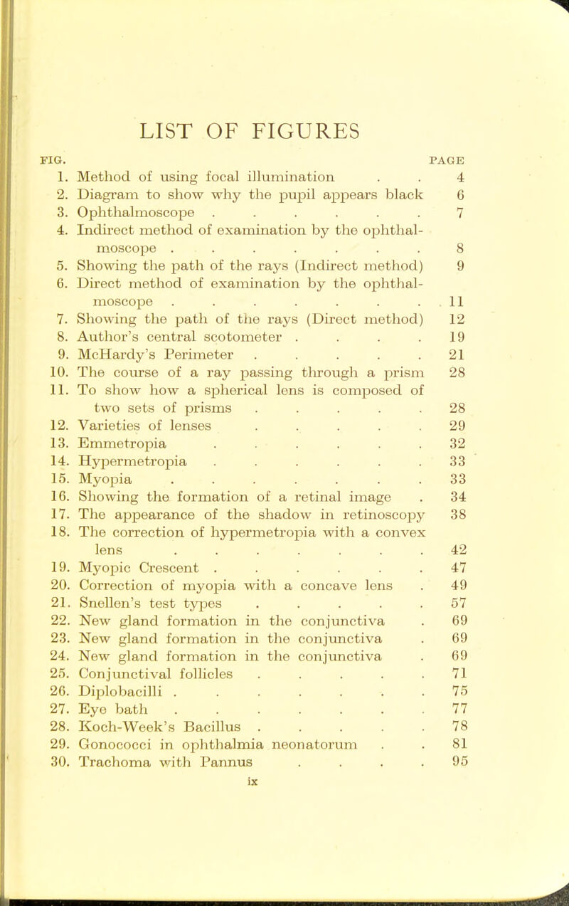 FIG. PAGE 1. Method of using focal illumination . . 4 2. Diagram to show why the pupil appears black 6 3. Ophthalmoscope ...... 7 4. Indirect method of examination by the ophthal- moscope ....... 8 5. Showing the path of the rays (Indirect method) 9 6. Direct method of examination by the ophtlial- moscope . . . . . . .11 7. Showing the path of the rays (Direct method) 12 8. Author's central scotometer . . . .19 9. McHardy's Perimeter . . . . .21 10. The coLu-se of a ray passing tlxrough a prism 28 11. To show how a spherical lens is composed of two sets of prisms ..... 28 12. Varieties of lenses ..... 29 13. Emmetroiaia ...... 32 14. Hypermetropia . . . . . .33 15. Myopia ....... 33 16. Showing the formation of a retinal image . 34 17. The appearance of the shadow in retinoscopy 38 18. The correction of hypermetropia with a convex lens ....... 42 19. Myopic Crescent ...... 47 20. Correction of myopia with a concave lens . 49 21. Snellen's test types ..... 57 22. New gland formation in the conjunctiva . 69 23. New gland formation in the conjimctiva . 69 24. New gland formation in the conjunctiva . 69 25. Conjunctival follicles ..... 71 26. Diiolobacilli 75 27. Eye bath 77 28. Koch-Week's Bacillus 78 29. Gonococci in ophthalmia neonatorum . . 81 30. Trachoma v/ith Pannus .... 95