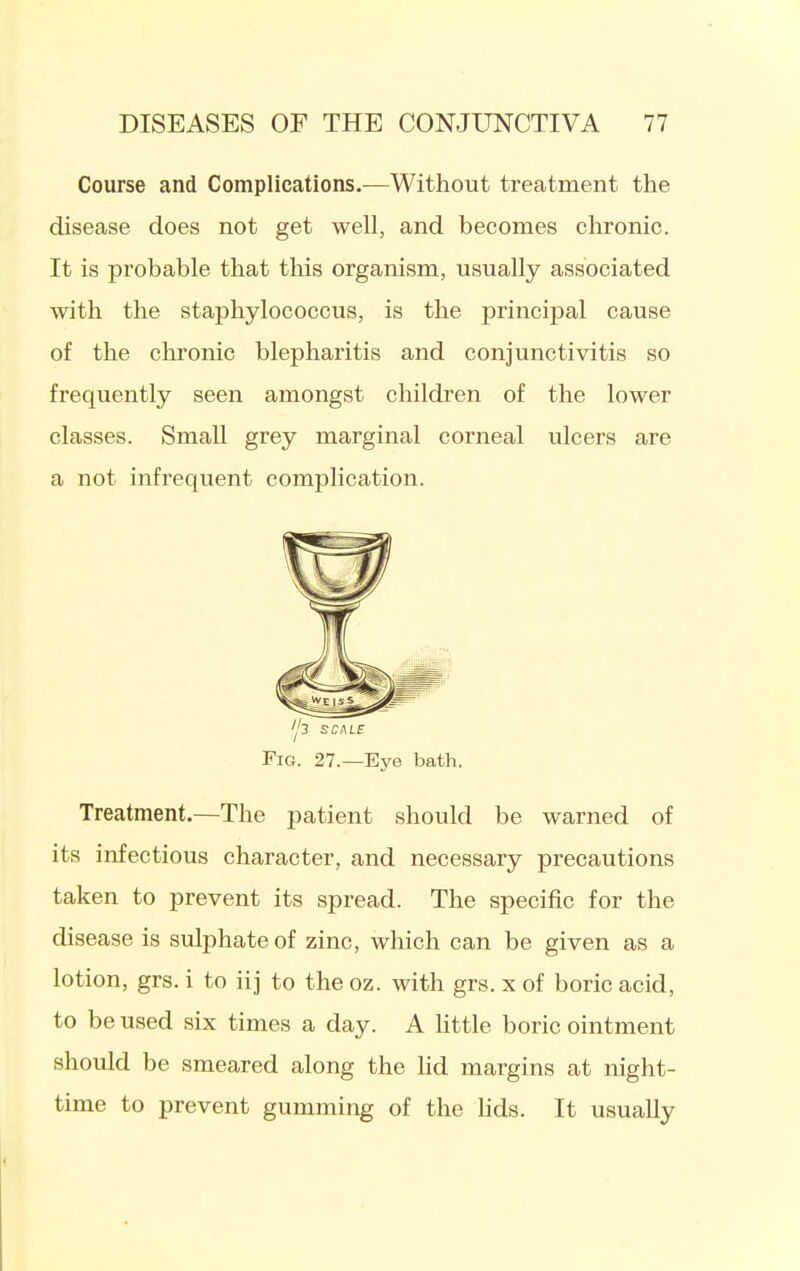 Course and Complications.—Without treatment the disease does not get well, and becomes chronic. It is probable that this organism, usually associated with the staphylococcus, is the principal cause of the chronic blepharitis and conjunctivitis so frequently seen amongst children of the lower classes. Small grey marginal corneal ulcers are a not infrequent complication. Fig. 27.—Eye bath. Treatment.—The patient should be warned of its infectious character, and necessary precautions taken to prevent its spread. The specific for the disease is sulphate of zinc, which can be given as a lotion, grs. i to iij to the oz. with grs. x of boric acid, to be used six times a day. A httle boric ointment should be smeared along the Hd margins at night- time to prevent gumming of the Hds. It usually