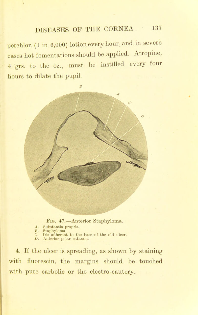 perchlor. (1 in 6,000) lotion every hour, and in severe cases hot fomentations should be appHed. Atropine, 4 grs. to the oz., must be instilled every four hours to dilate the pupil. Fig. 47.—Anterior Staphyloma. A. Substantia propria. B. Stapliyloma. C. Iris adlierent to the base o£ the old ulcer. D. Anterior polar cataract. 4. If the ulcer is spreading, as shown by staining with fluorescin, the margins should be touched with pure carbolic or the electro-cautery.