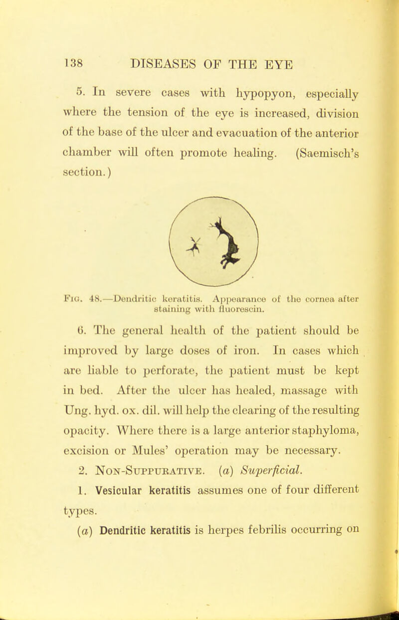 5. In severe cases with hypopyon, especially where the tension of the eye is increased, division of the base of the ulcer and evacuation of the anterior chamber wHl often promote heaUng. (Saemisch's section.) Fig. 48.—Dendritic keratitis. Appearance of the cornea after staining with fluorescin. 0. The general health of the patient should be improved by large doses of iron. In cases wliich are hable to jjerforate, the patient must be kept in bed. After the ulcer has healed, massage with Ung. hyd. ox. dU. will help the clearing of the resulting opacity. Where there is a large anterior staphyloma, excision or Mules' operation may be necessary. 2. NoN-SuppuBATiVE. (a) Superficial. 1. Vesicular keratitis assumes one of four different types. (a) Dendritic keratitis is herpes febrihs occmring on