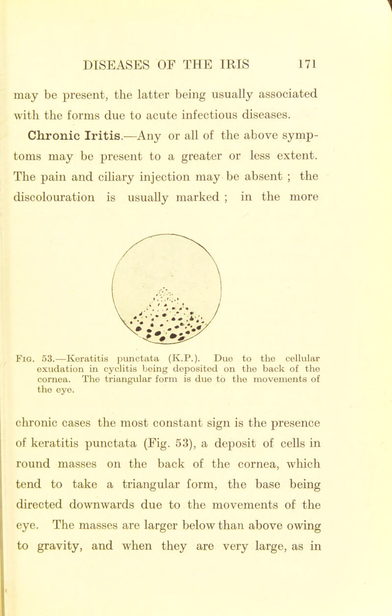 may be present, the latter being usually associated with the forms due to acute infectious diseases. Chronic Iritis.—Any or all of the above symp- toms may be present to a greater or less extent. The pain and ciliary injection may be absent ; the discolouration is usually marked ; in the more Fig. 53.—Keratitis pimctata (K.P.). Due to the cellular exudation in cyclitis being deposited on the back of the cornea. The triangular form is due to the movements of the eye. chronic cases the most constant sign is the presence of keratitis punctata (Fig. 53), a deposit of cells in round masses on the back of the cornea, which tend to take a triangular form, the base being directed downwards due to the movements of the eye. The masses are larger below than above owing to gravity, and when they are very large, as in